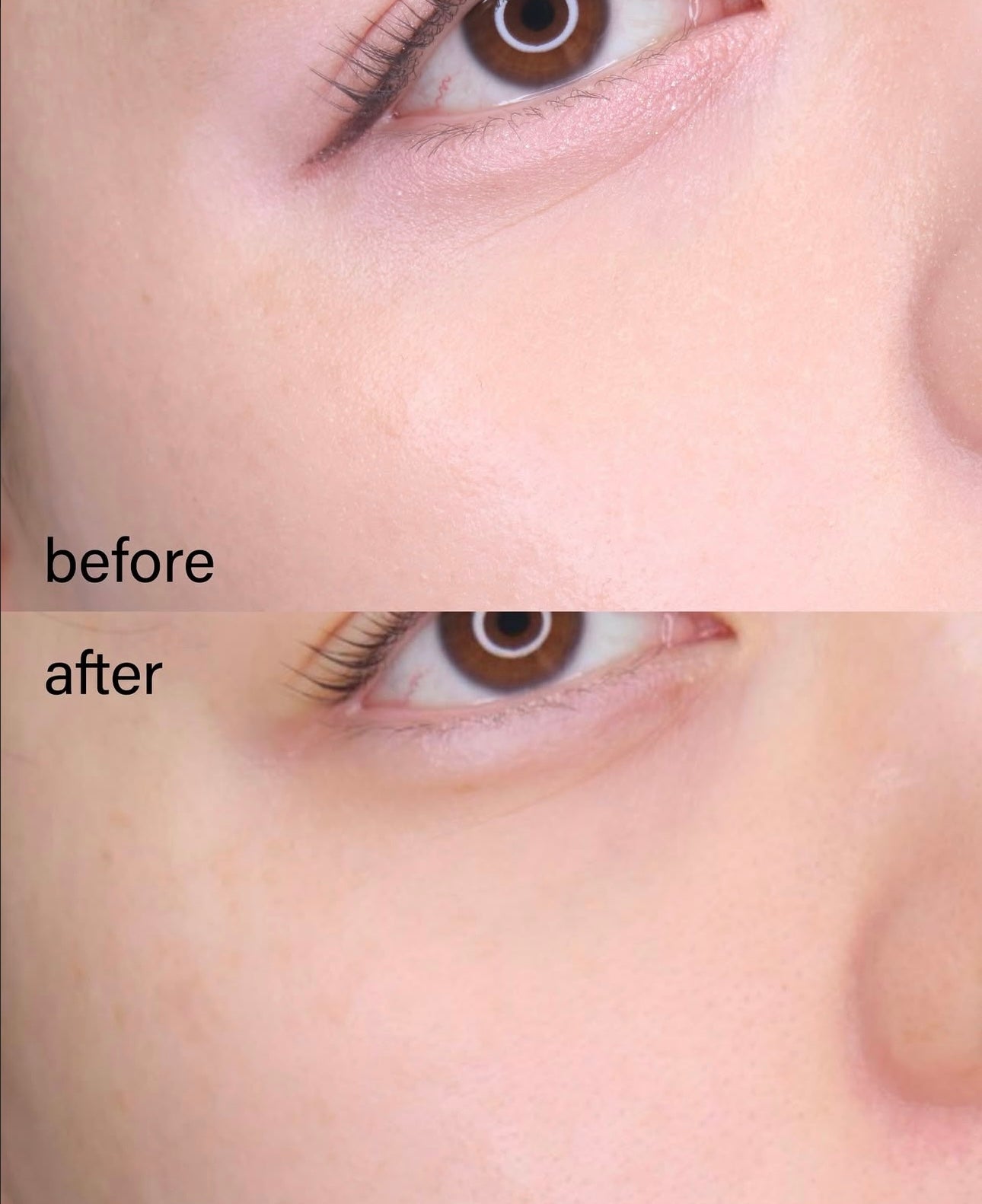 輕輕一扭即可使用✨Beplain 綠豆清毛孔研磨扭扭牛奶卸妝膏💚Beplain Mung Bean Pore Grinding Cleansing Balm