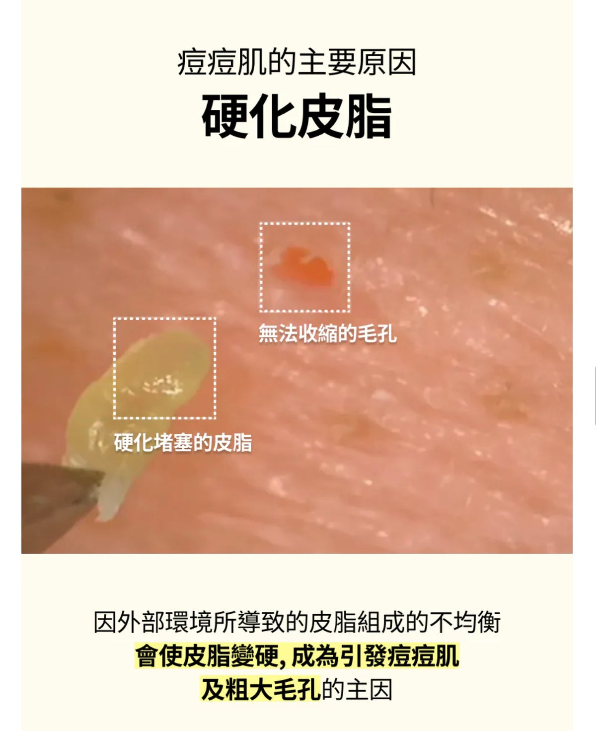 限定Minions版🍌韓國爆紅🔥 痘肌爛面救星🙋🏼‍♀️Celladix 皮脂平衡去痘131 精華液✨ Celladix Trouble Sebum Rebalancing 131 Ampoule