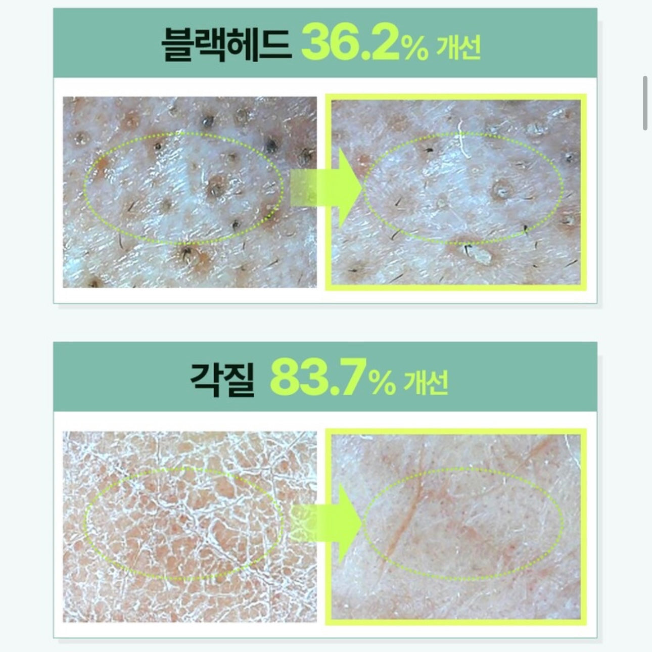 送Hello Kitty潔面刷✨ilso天然溫和溶黑頭清毛孔卸妝油套裝Ilso natural mild cleansing oil set🪄