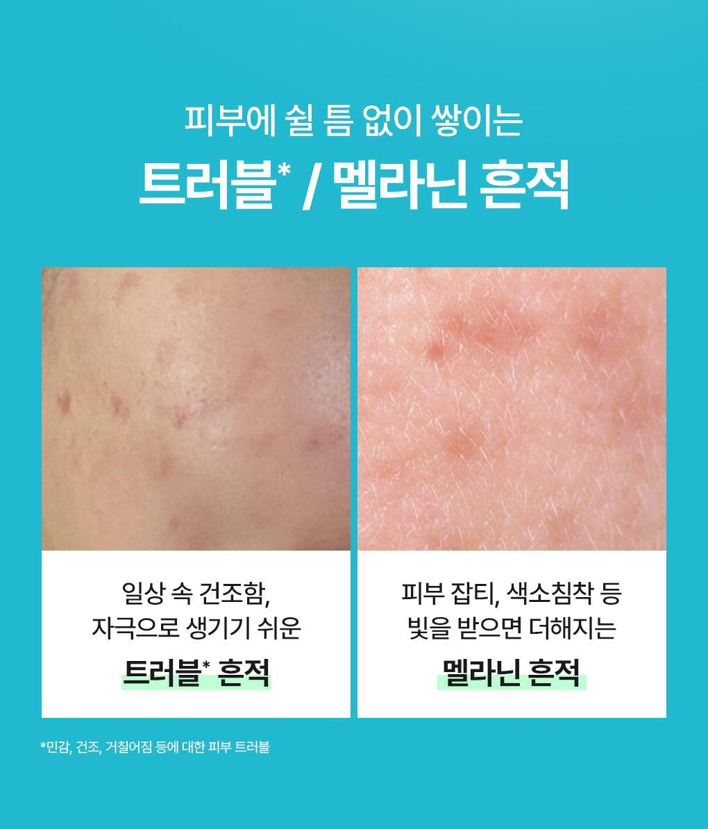 共6款！MEDIHEAL 包裹式精華面膜系列✨