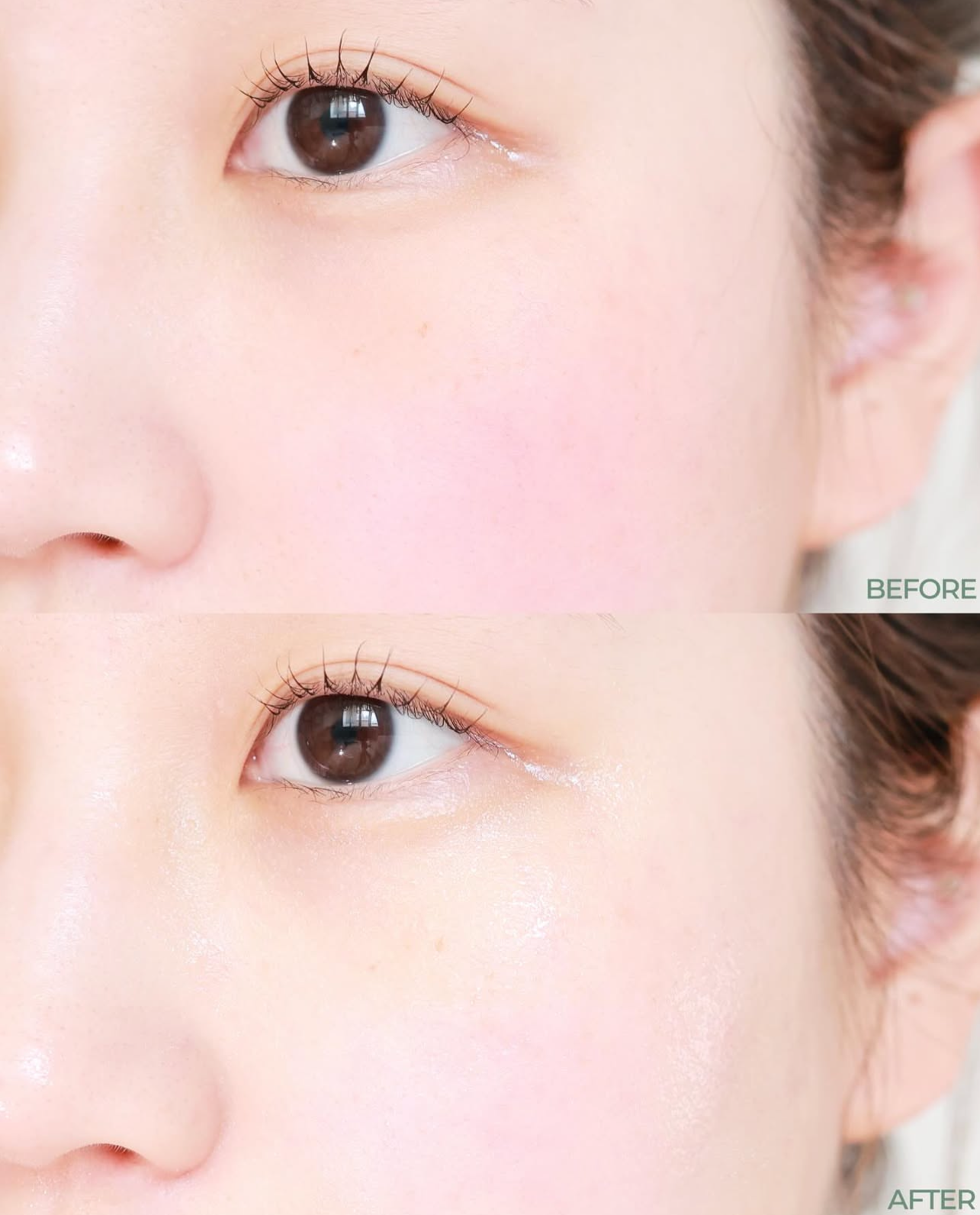 送面霜/爽膚水✨新升級⭐️ Torriden 積雪草控油去痘舒緩精華🌿 | Torriden Balanceful Control Serum| 專為油痘肌敏感肌打造⭐️