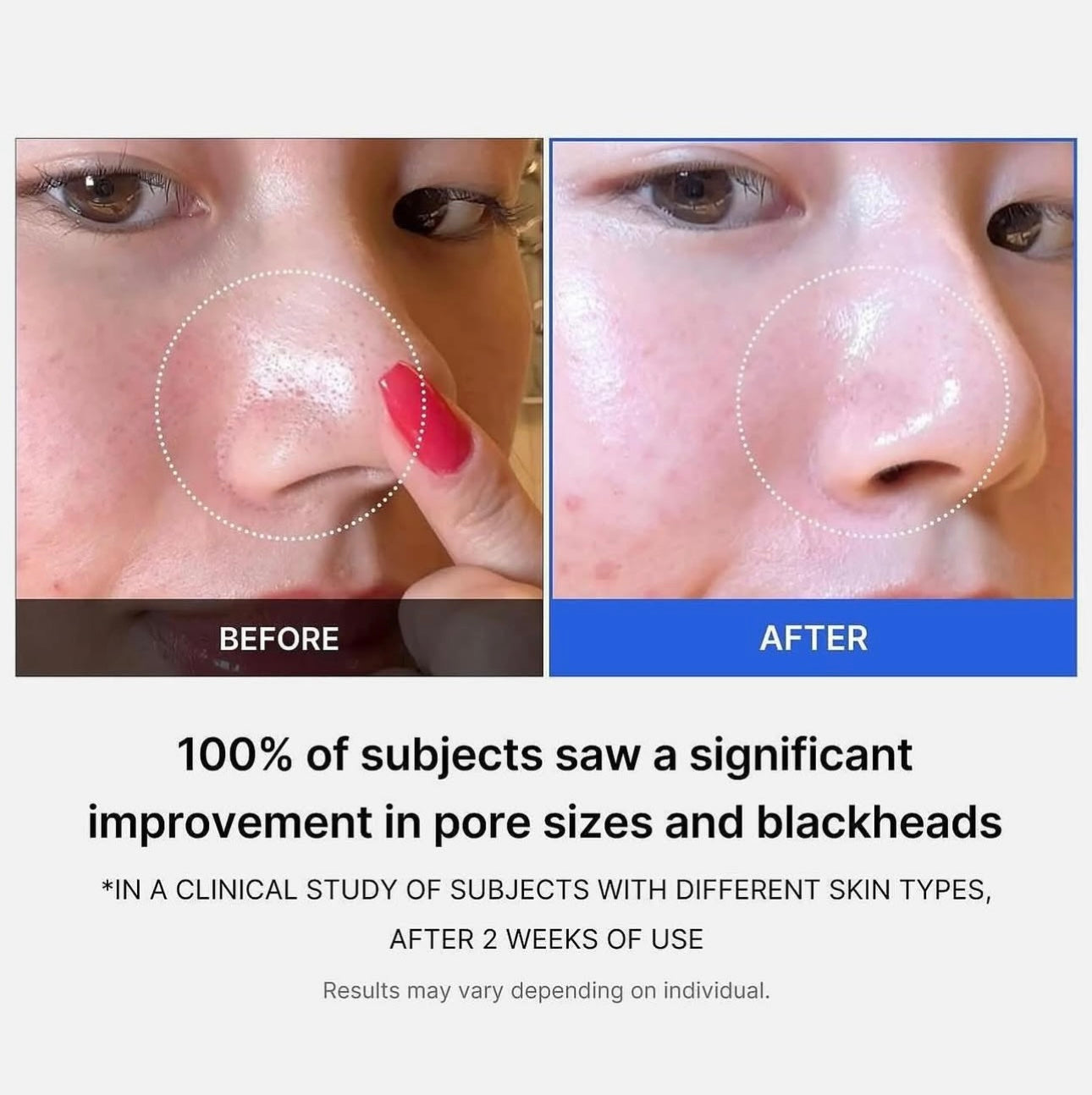 2個星期看到毛孔緊致效果✨| Medicube 緊緻收縮毛孔面霜 | Medicube Zero Pore Cream 2.0| 通過韓國皮膚科學研究院認證🏥