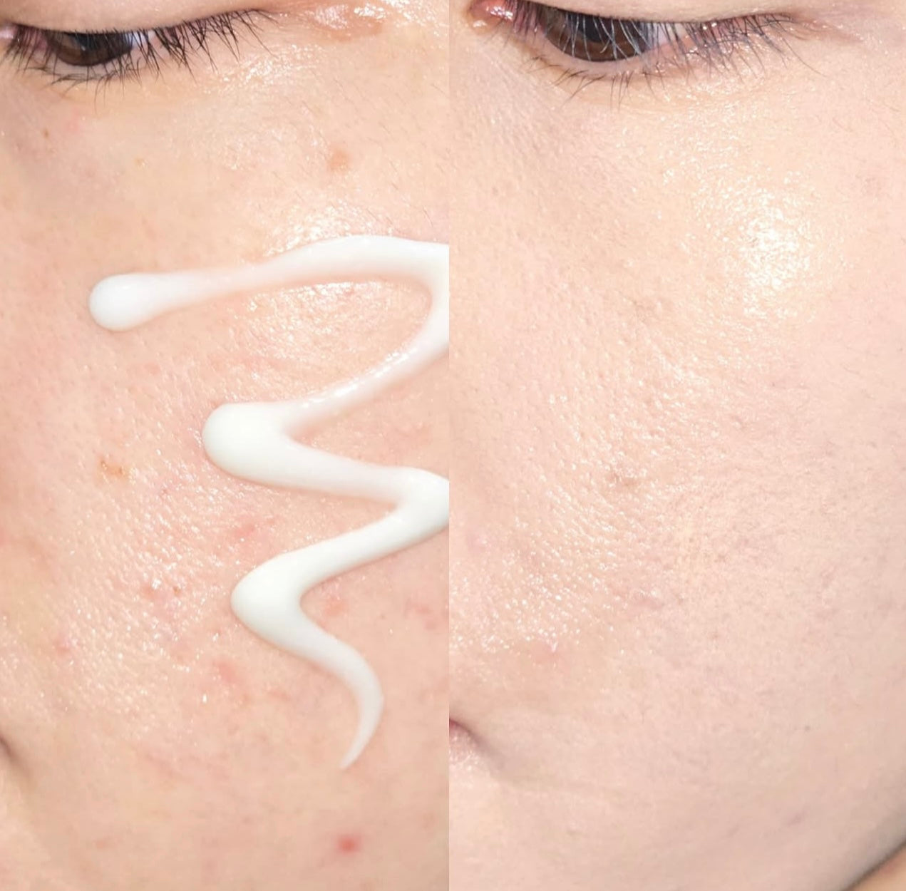 韓國專業醫美級護膚品牌👩🏼‍⚕️|DERMAFIRM 谷胱甘肽去瑕疵光感面霜💜✨| 雙重美白成分⭐️| DERMAFIRM SOOTHING REPAIR TONING CREAM