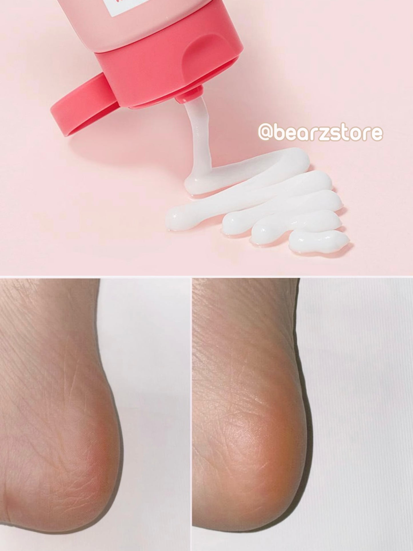 送死皮刮刀✨Plu 強效角蛋白強化修護足霜+完美足部去角質套裝 🦶🏻| PLU Intensive Repair Foot Cream