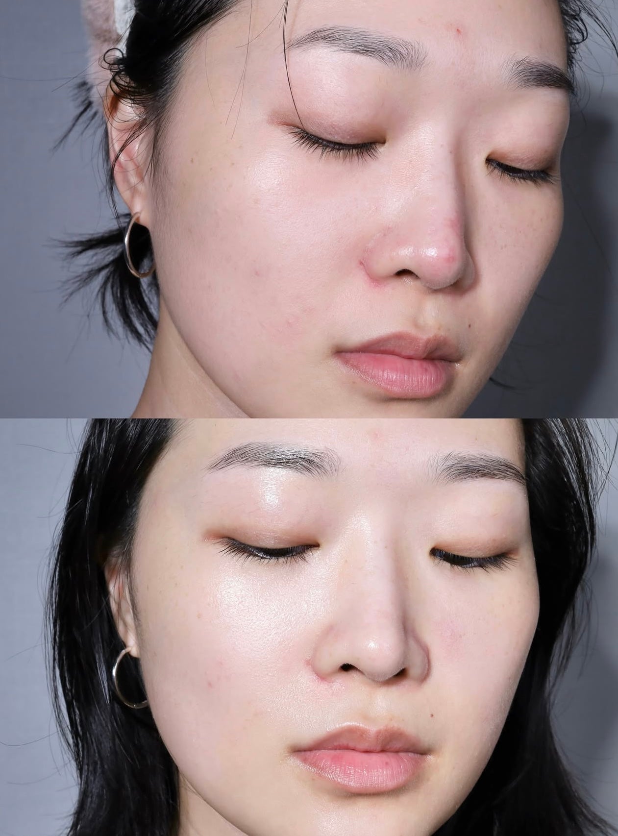 MEDIHEAL x 布丁狗🍮限量聯名✨升級版🔥強效淡印修復痕跡補水精華🩵 DERMA SERUM MADECASSOSIDE
MOISTURE BLEMISH