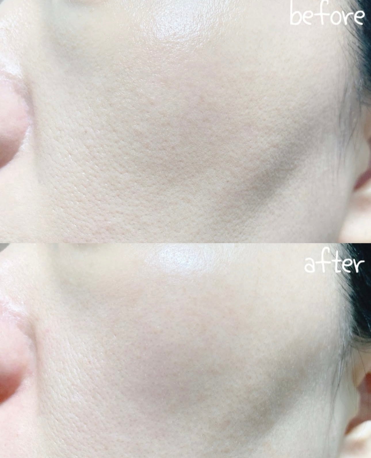 巨量裝🔥自留🌿韓國 Hwahae 美容大賞 No.1✨| Beplain 平衡pH值氨基酸絲滑綠豆洗面奶Beplain Greenful pH-balanced Cleansing Foam | 滿意度高達 98.4%🌿