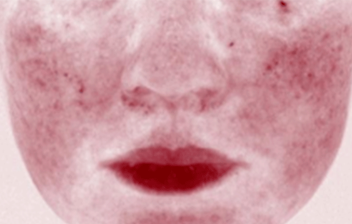 送Sally Brown鏡子匙扣✨Banila Co皇牌零感舒緩鎮靜深層潔淨卸妝膏💖 Banila Co Clean It Zero All In One Cleanser