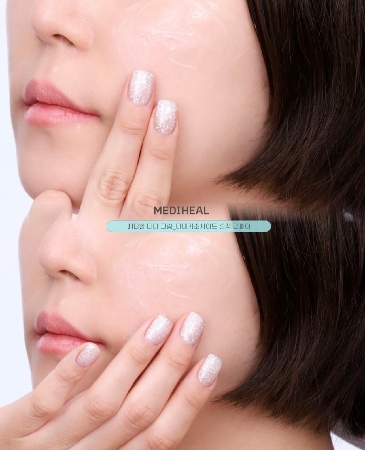 MEDIHEAL 98%積雪草抗炎去印去痕跡修護霜🩵| MEDIHEAL MADECASSOSIDE DERMA ACTIVE CAPSULE CREAM