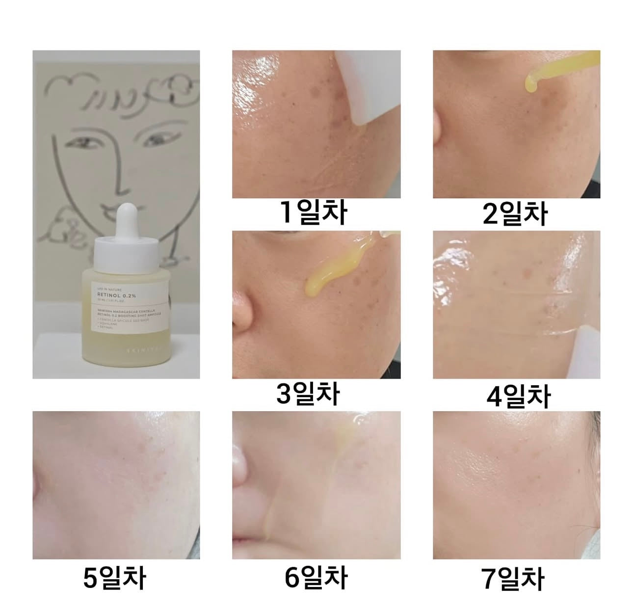 Skin1004馬達加斯加積雪草溫和 A醇微針微導精華0.2%濃度⭐️Skin1004 Retinol 0.2 Boosting Shot Ampoule | 無痛煥膚的秘密在這 ✨