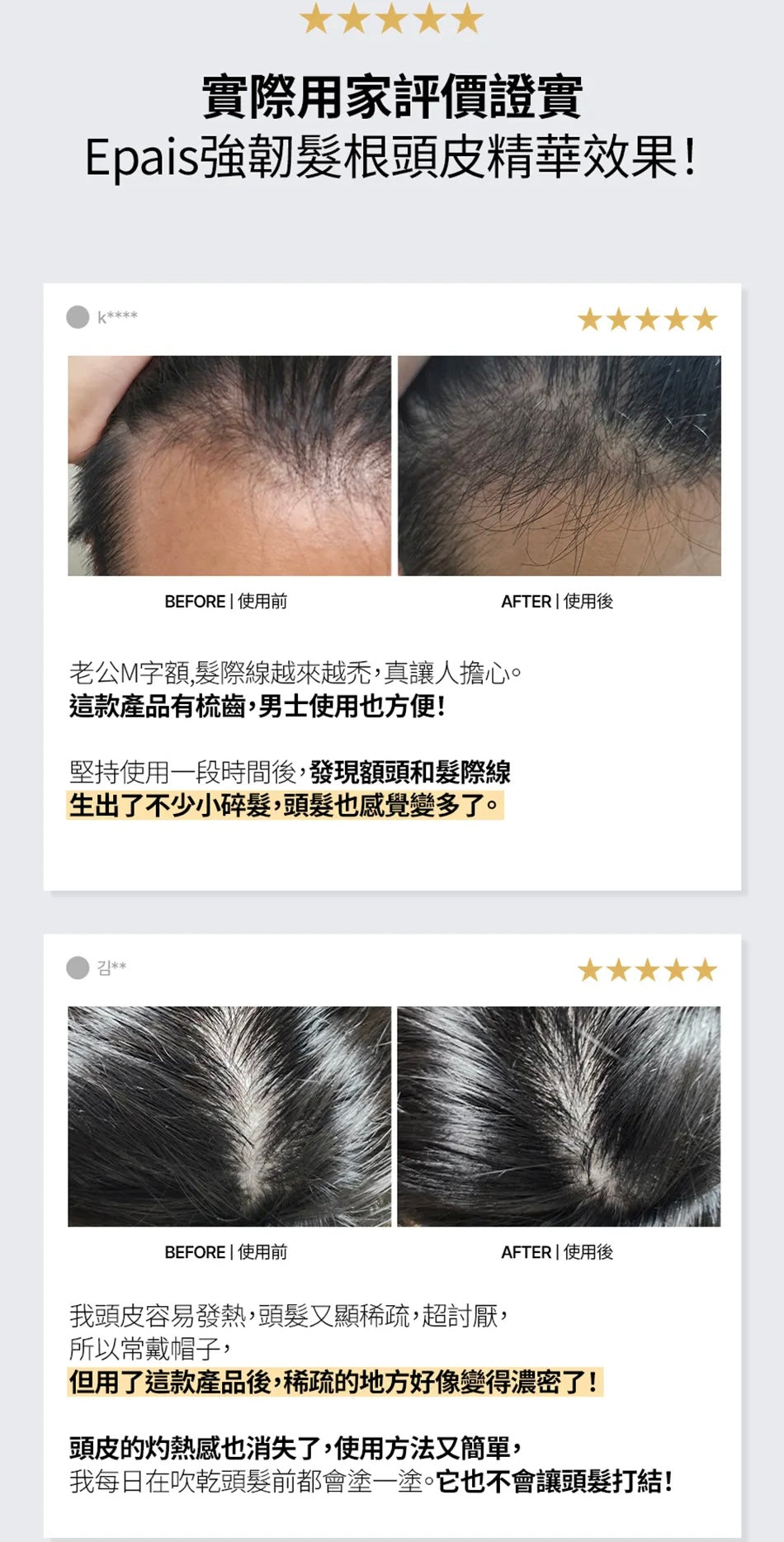 🔥【防脫髮僅需2星期】EPAIS 髮根賦活頭皮精華 🩶 EPAIS Scalp Boosting Ampoule✨