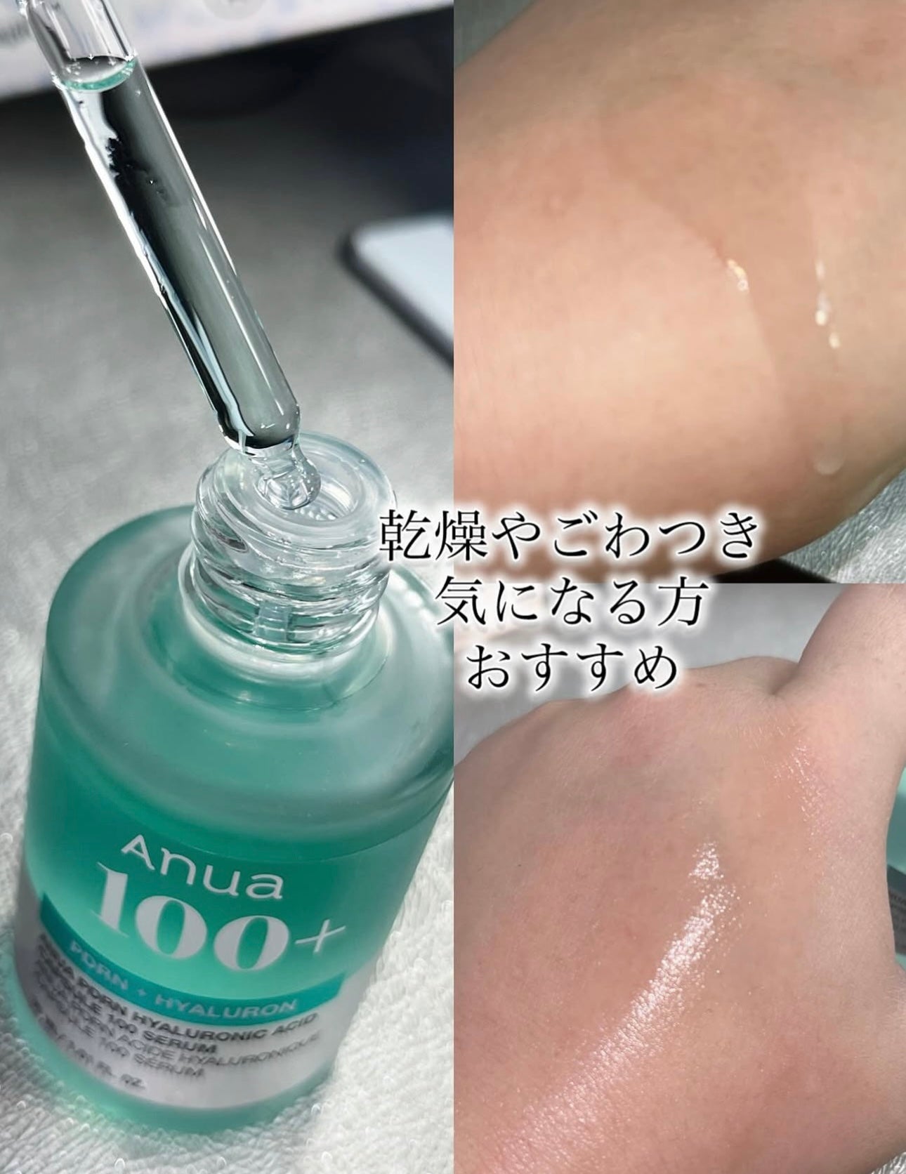 送面霜+棉片🩵水光肌的秘密武器🪄| Anua PDRN 透明質酸膠囊超強補濕精華 🌊 醫美級水光修復精華✨ 化解榜保濕精華 第1名🏆| Anua PDRN Hyaluron Capsule 100 Serum💧