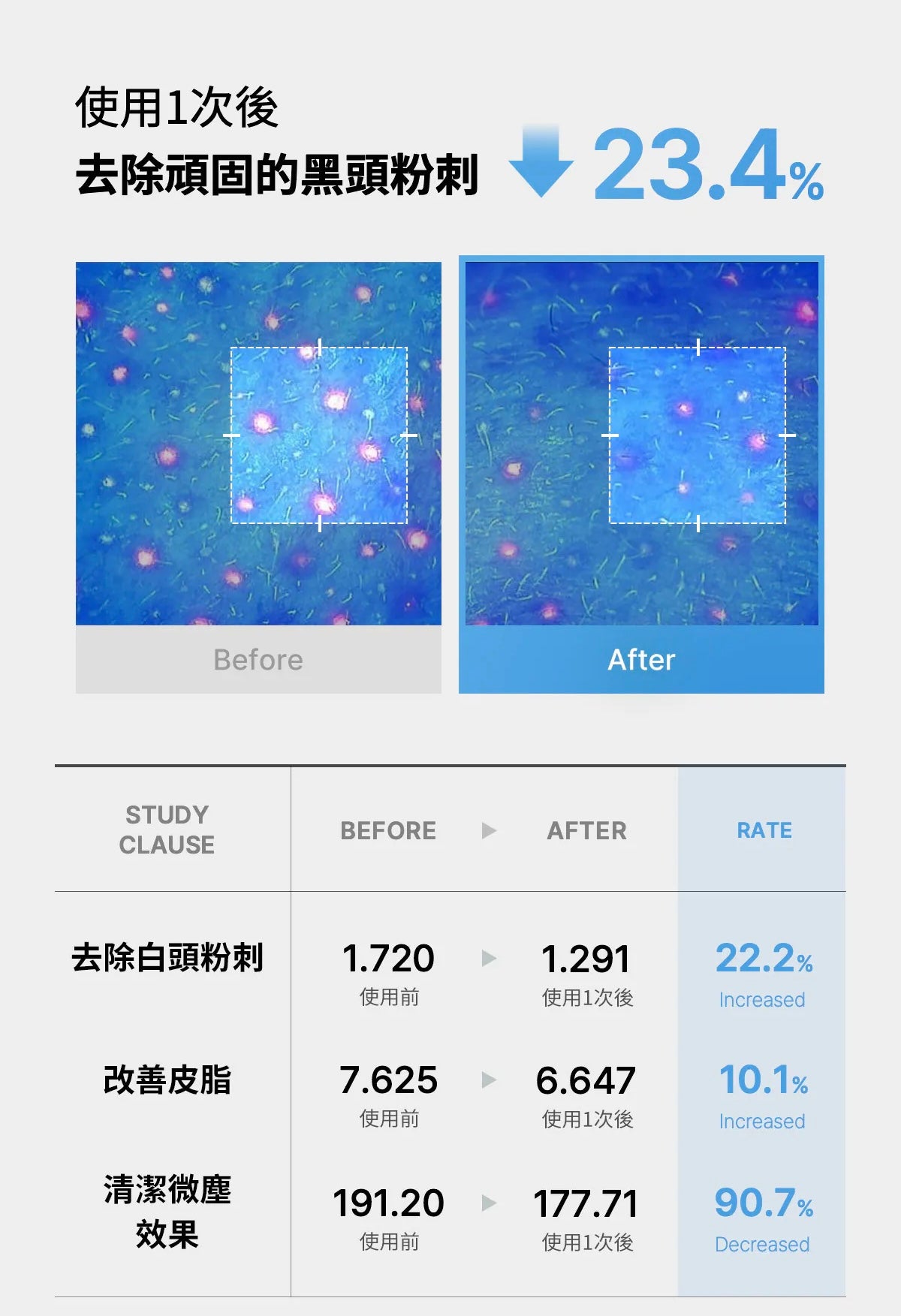 Medicube Zero黑頭毛孔淨化卸妝油🩵| Medicube Zero Pore Blackhead Deep Cleansing Oil