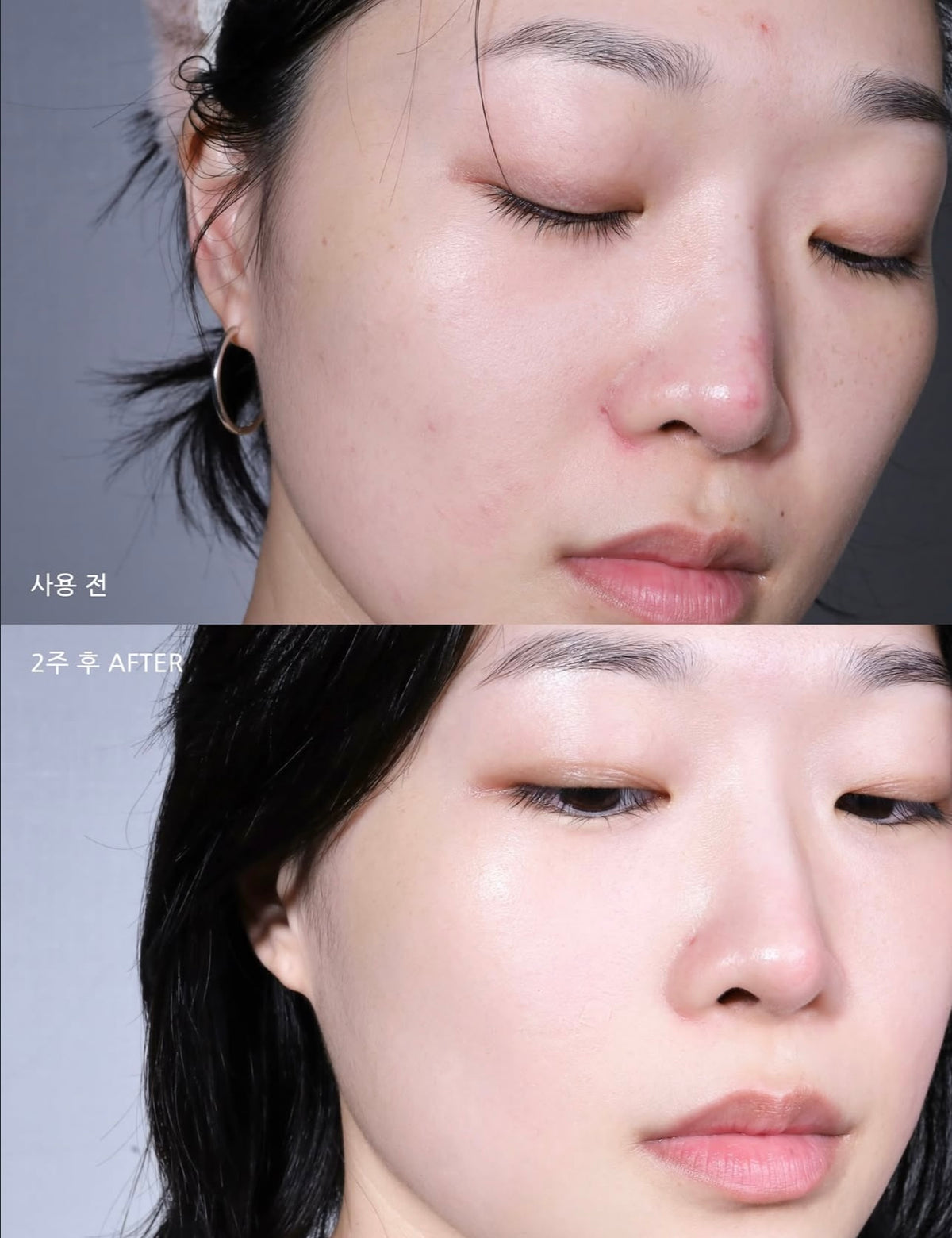 MEDIHEAL x 布丁狗🍮限量聯名✨升級版🔥強效淡印修復痕跡補水精華🩵 DERMA SERUM MADECASSOSIDE
MOISTURE BLEMISH