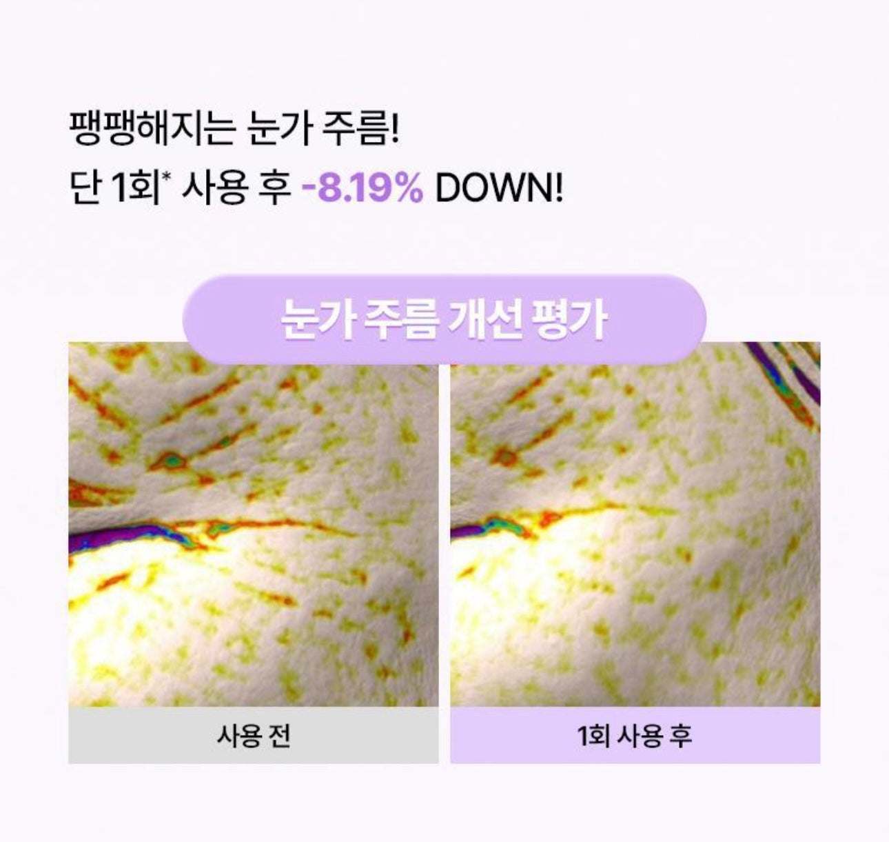 4週見證眼周逆齡力💫| BOH BIO HEAL PROBIODERM 高濃度膠原重塑眼膜