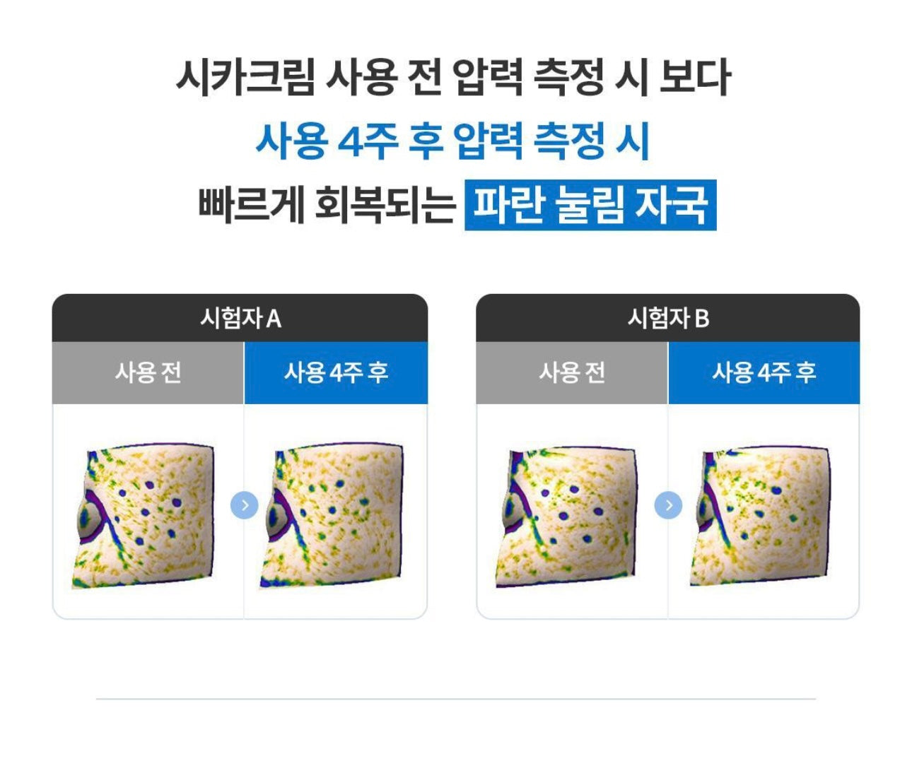 送旅行裝✨全球皮膚科醫師推薦👩🏼‍⚕️La Roche-Posay Cicaplast B5+全面修復萬用霜🩵