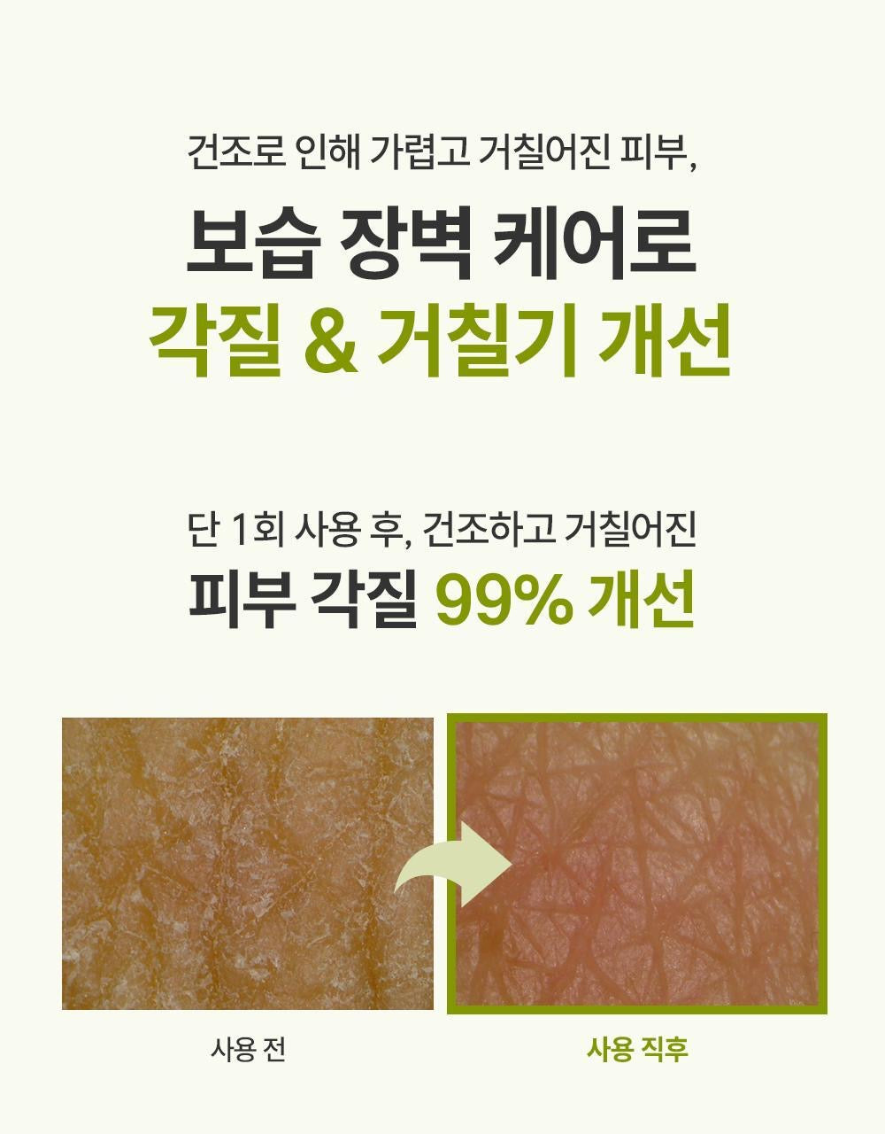 ZEROID 急救密集修護霜| 榮獲 2025 OLIVE YOUNG 大賞「MD推薦」🏆