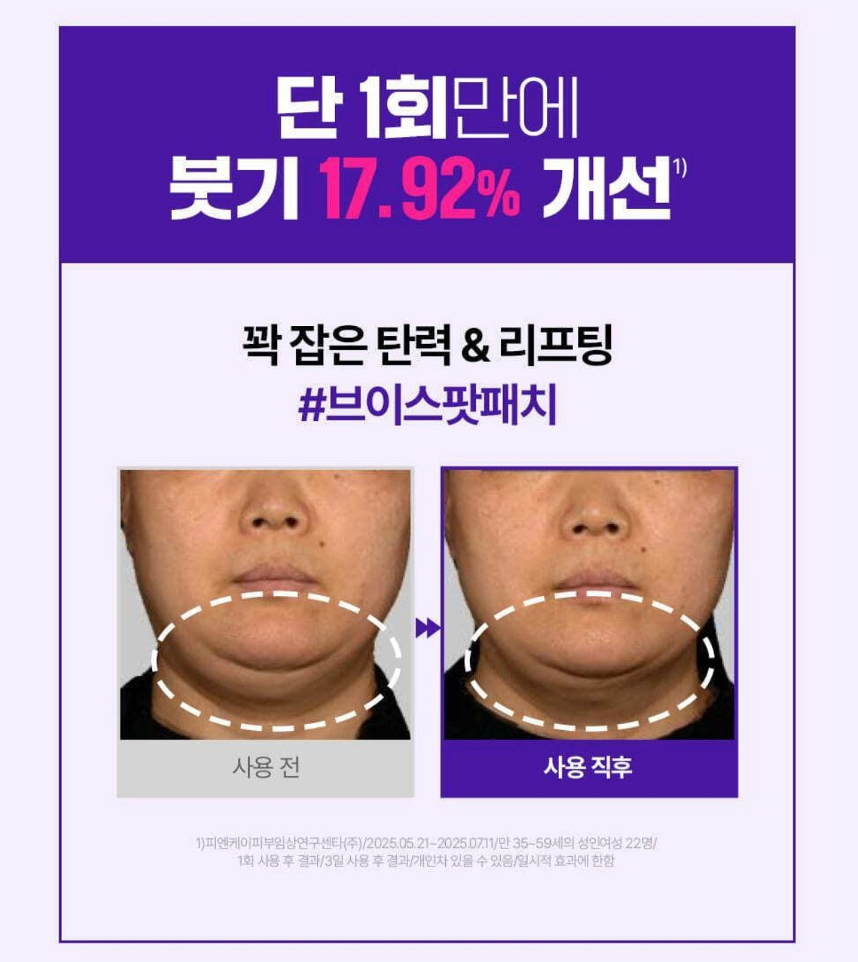 ✨ 抗老黑科技！一夜拉出「少女緊緻線」🪄Dermafirm 500道爾頓超微分子膠原蛋白微針彈力拉提貼💉