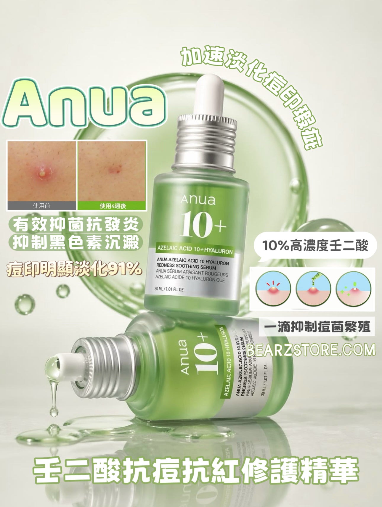 超多客人搵佢🔥告別煩人粉刺、紅疹、痘印⭐️Anua Azelaic壬二酸10%抗痘抗紅修護精華💚 Anua Azelaic Acid 10 Hyaluron Redness Soothing Serum