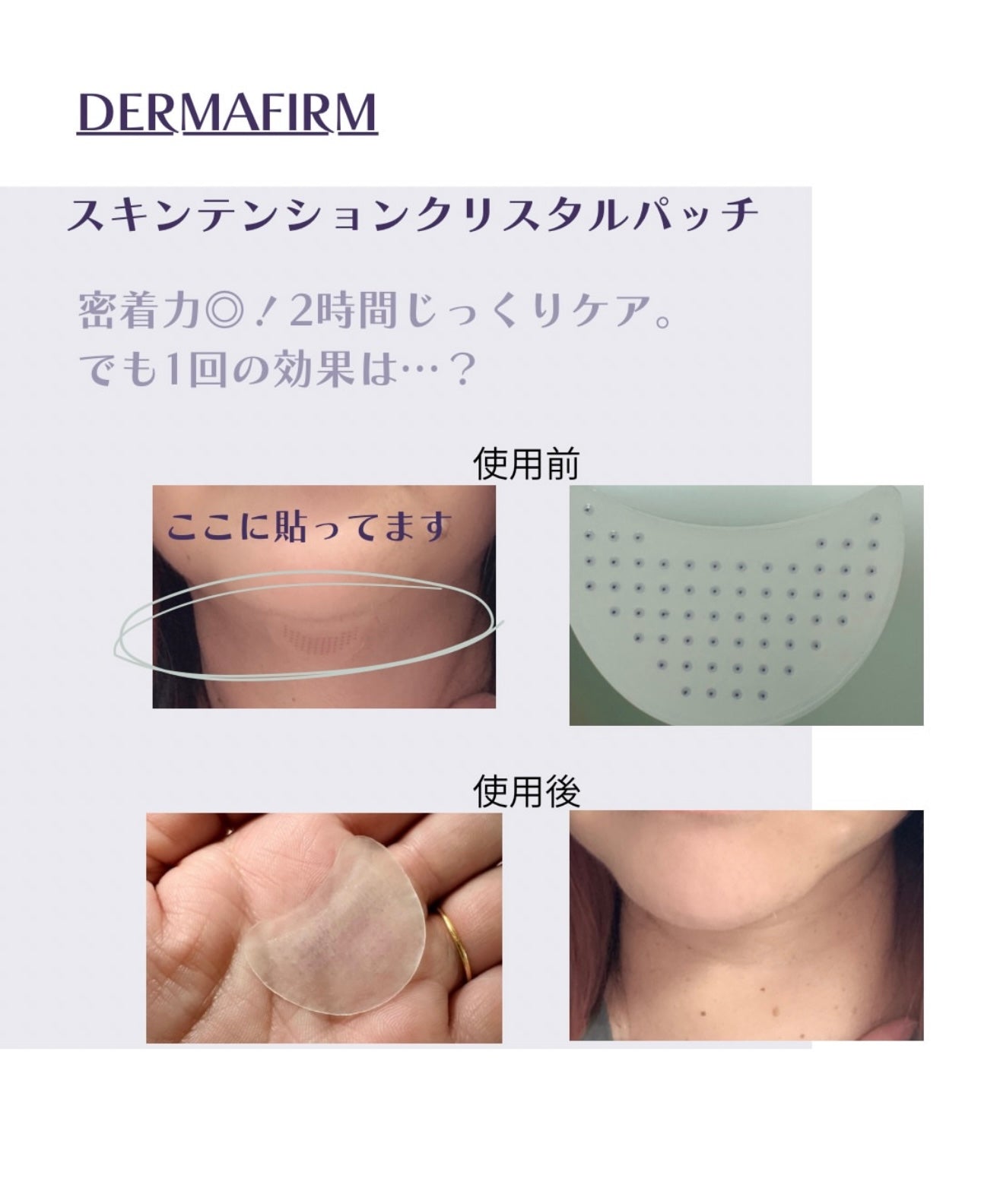 ✨ 抗老黑科技！一夜拉出「少女緊緻線」🪄Dermafirm 500道爾頓超微分子膠原蛋白微針彈力拉提貼💉