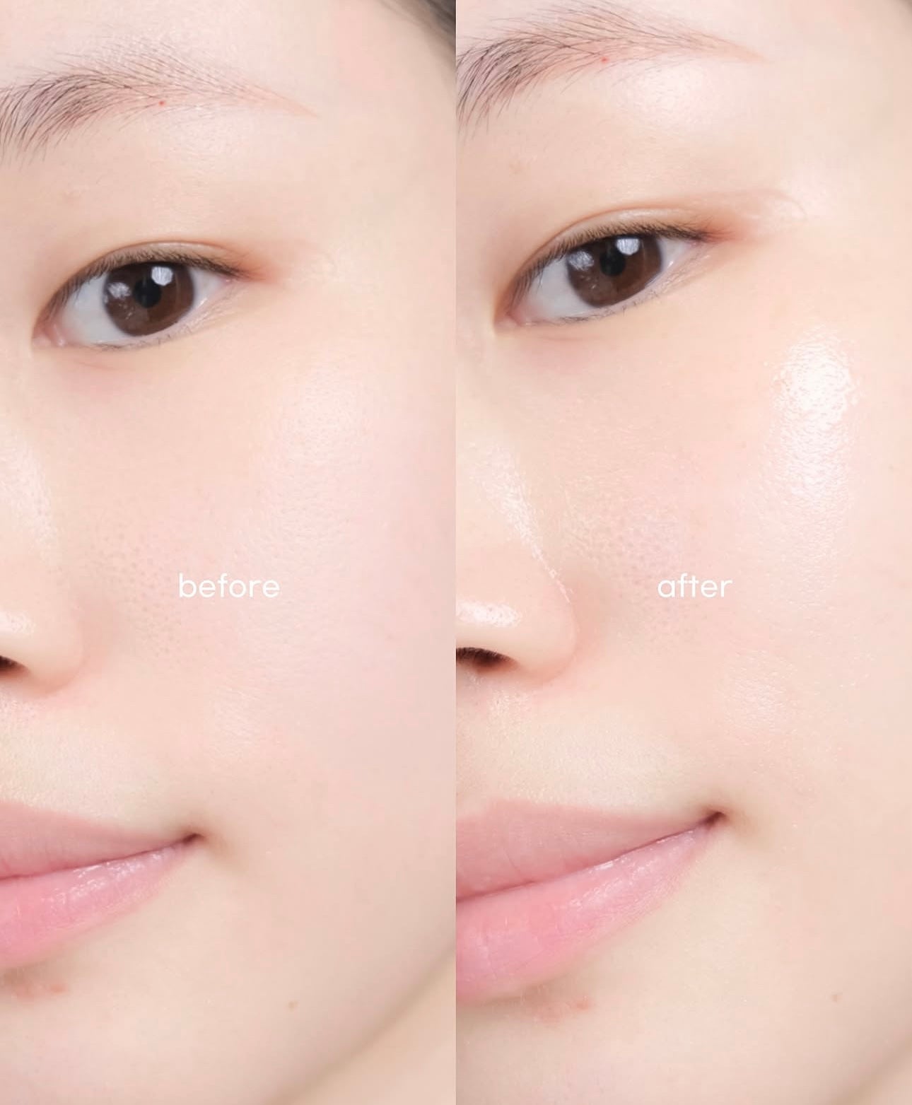 Skin1004馬達加斯加積雪草溫和 A醇微針微導精華0.2%濃度⭐️Skin1004 Retinol 0.2 Boosting Shot Ampoule | 無痛煥膚的秘密在這 ✨