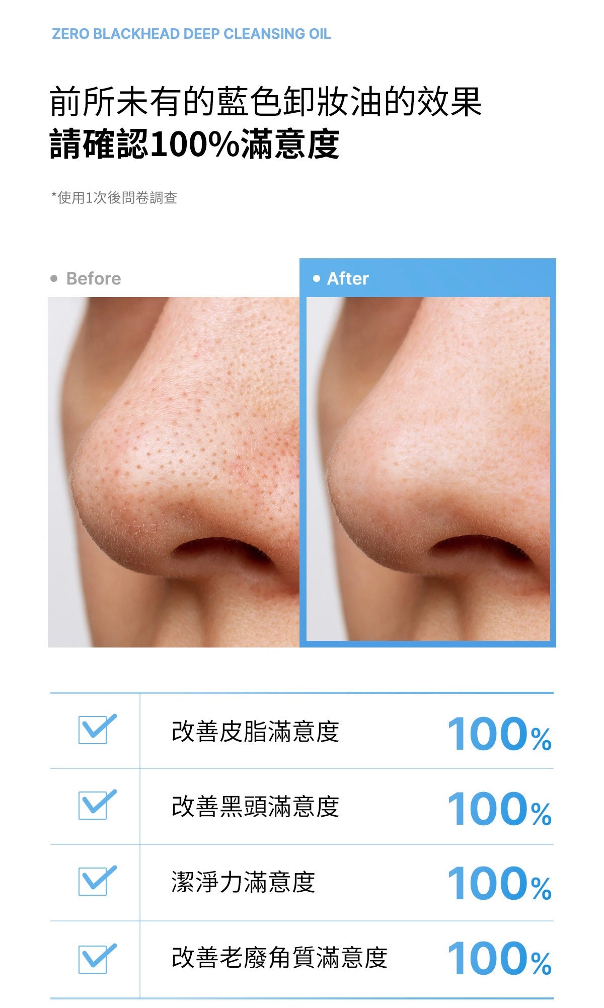 Medicube Zero黑頭毛孔淨化卸妝油🩵| Medicube Zero Pore Blackhead Deep Cleansing Oil