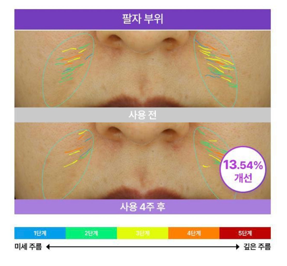 修復舒緩雙重加持💫BOH PROBIODERM 3D立體緊緻益生菌眼霜💜| BOH PROBIODERM 3D Lifting Eye & Wrinkle Cream