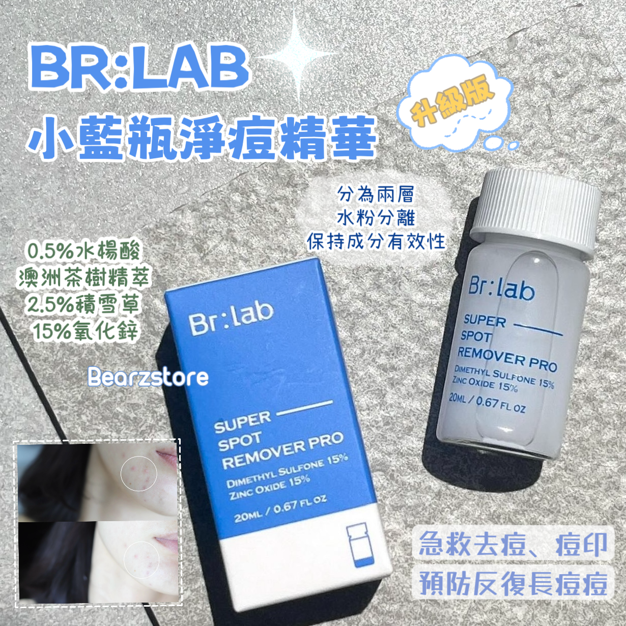 快速去痘 淡化痘印✨| BR:LAB 小藍瓶淨痘精華升級版🚨BR:LAB SUPER SPOT REMOVER PRO🩵