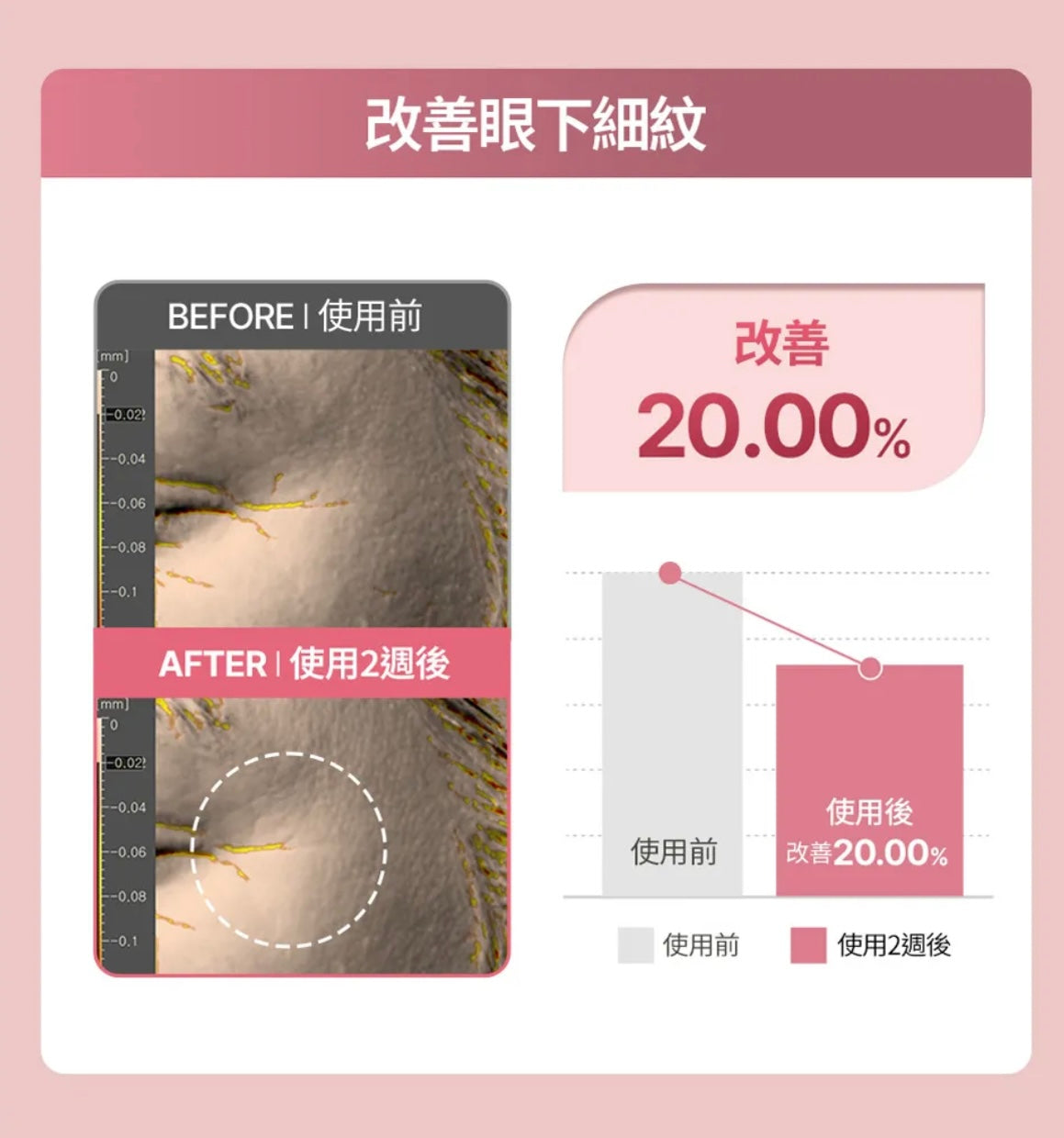 肌膚越用越年輕！Face Fit Wrinkle Patch 小熨斗皺紋貼 ⭐️