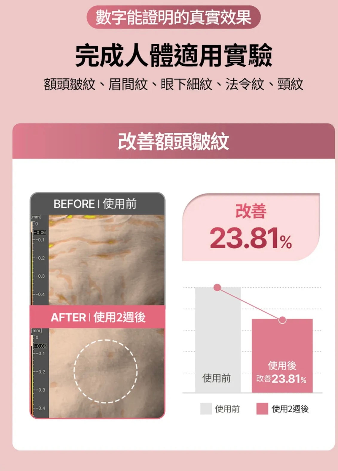 肌膚越用越年輕！Face Fit Wrinkle Patch 小熨斗皺紋貼 ⭐️