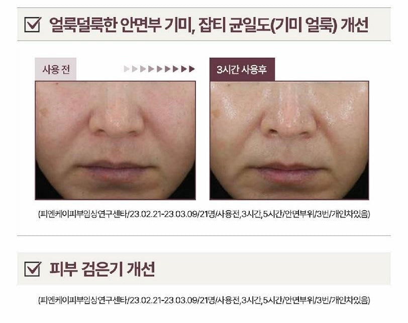 醫藥級研發⭐️Centellian24 高濃度美白修復精華| MAX韓國東國製藥研發的高效淡斑精華💛