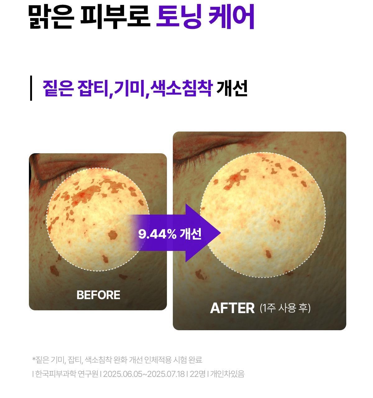 院線級修復🏥Centellian 24 PDRN 專家版高濃縮肌膚修復再生面霜✨ 醫美術後、敏感肌救星⭐️