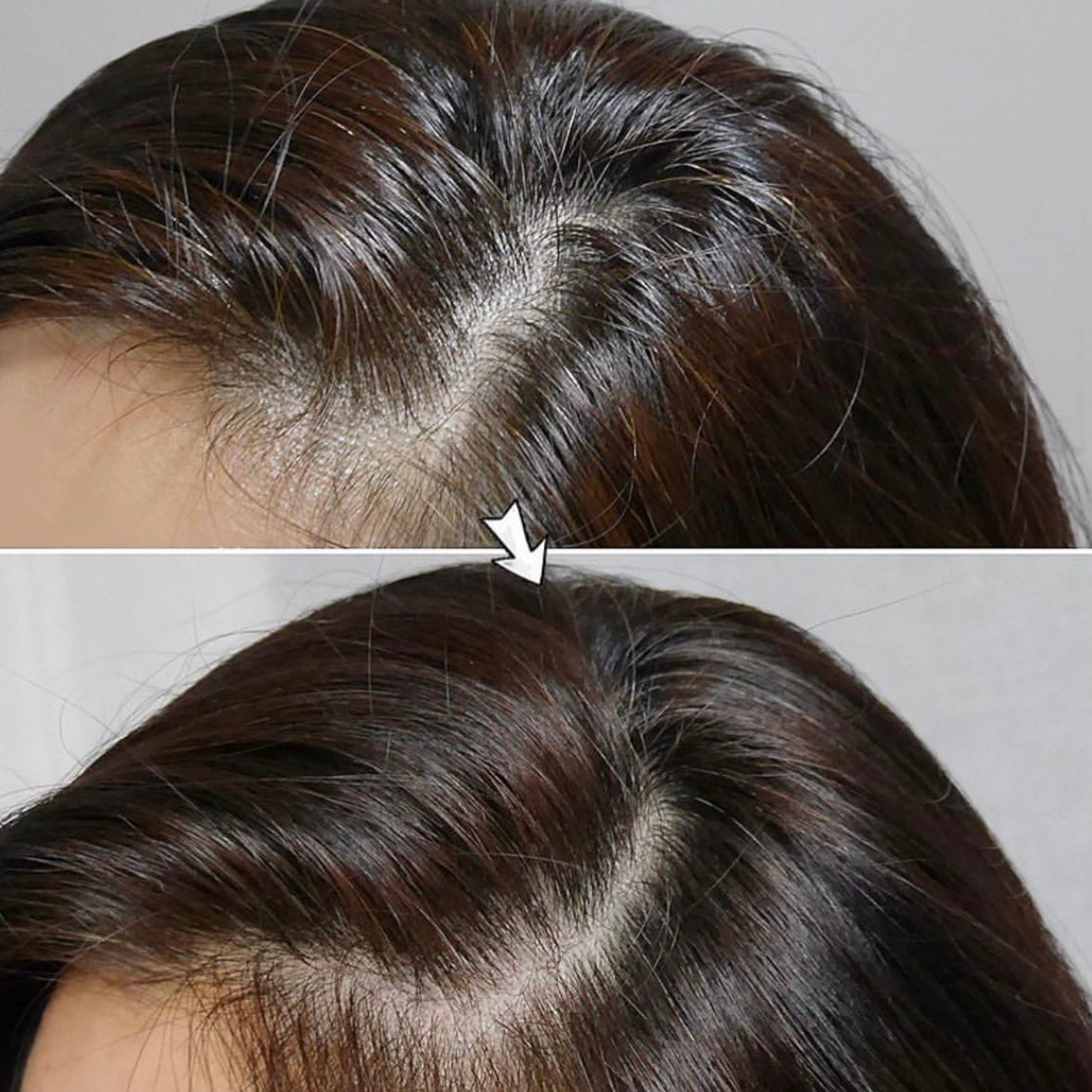 LABO-H HAIR LOSS RELIEF SHAMPOO專利益生菌防脫洗髮水🪄