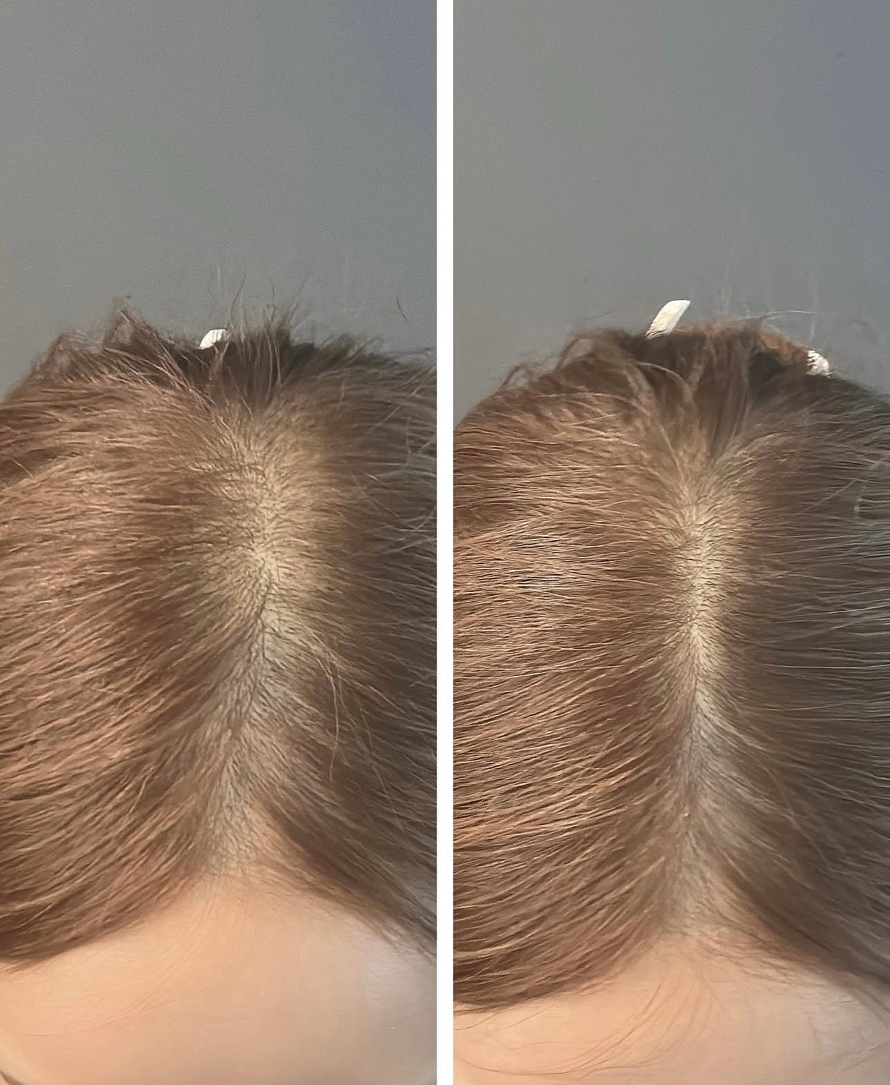 防脫髮專研🔥MOEV ANNURCATIN 防脫髮強韌養護洗髮水 GD & Rose 推薦🙋🏼‍♀️