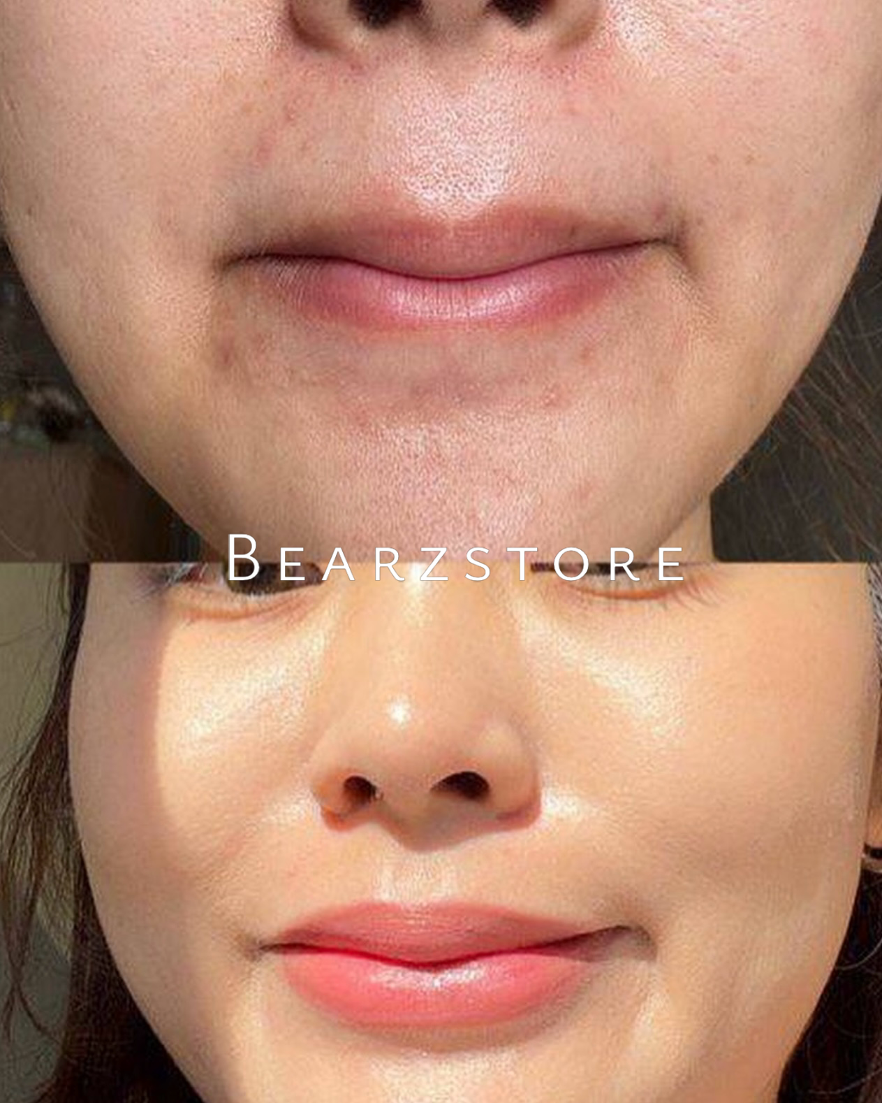 送緩解霜噴霧✨專爲解決痘痘爆發後遺症✨|Dr.Althea 345 白藜盧醇抗糖抗衰老去印修復霜🔥| Dr.Althea 345 Relief Cream