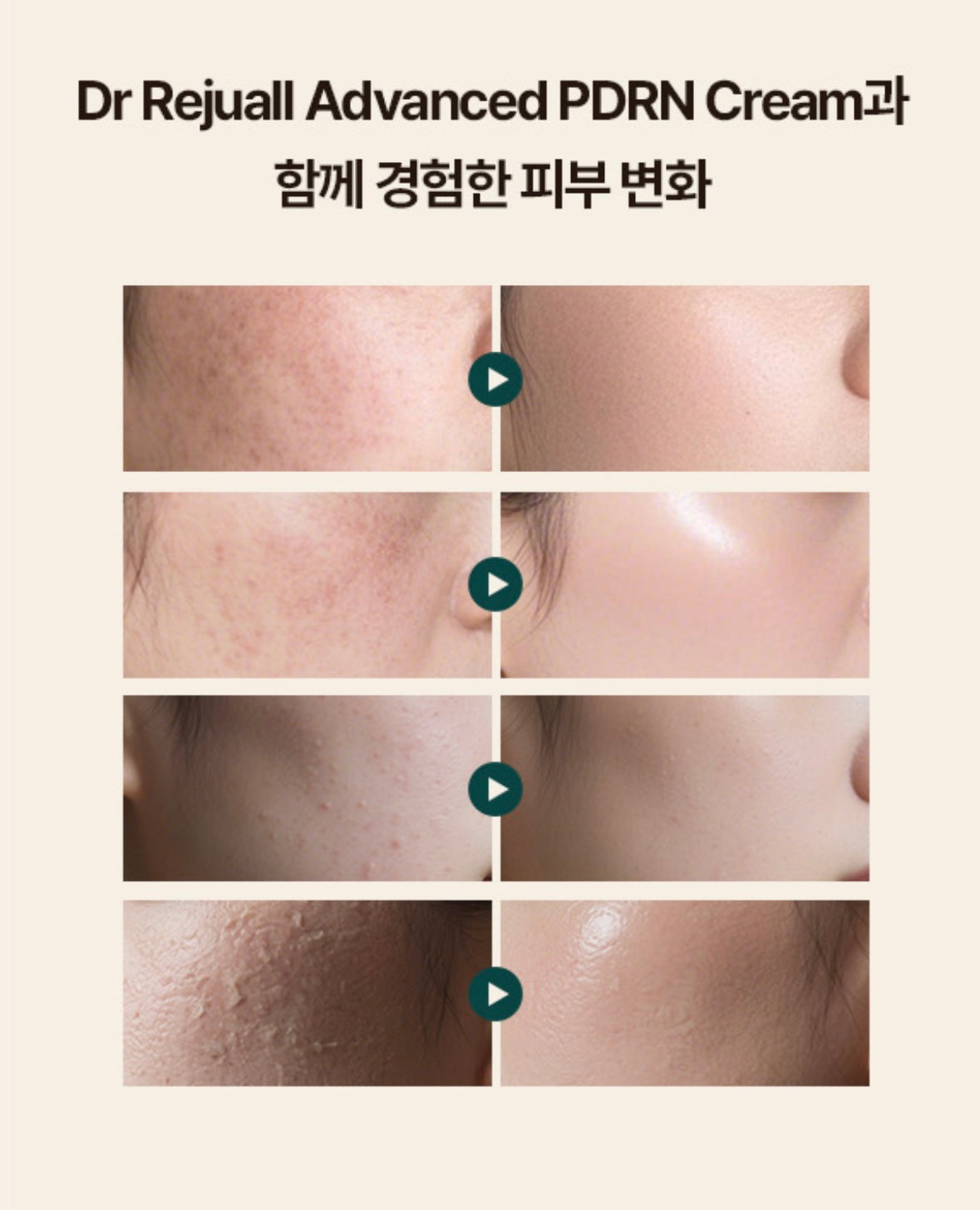 韓國藥房款🏥Rejuall 麗珠蘭高濃度PDRN底層修復再生霜⭐️|  Rejuall Advanced PDRN Relief Cream