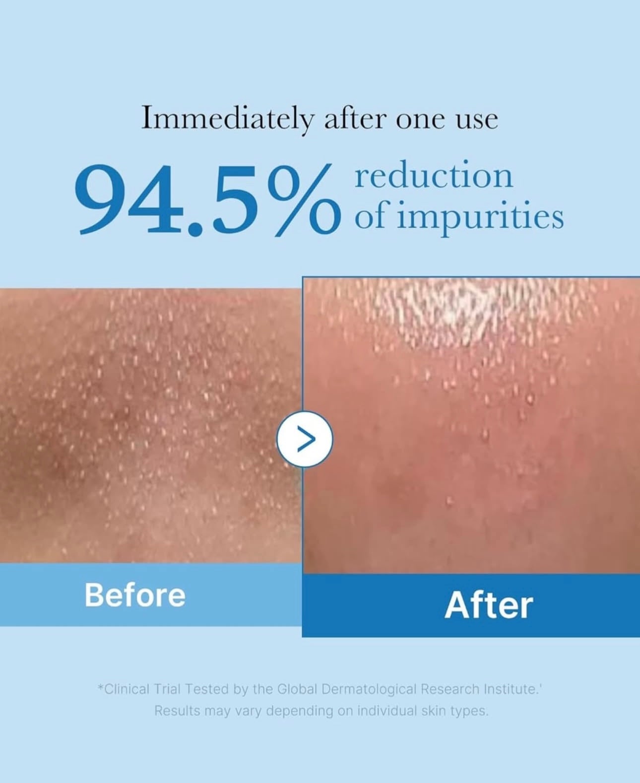 Medicube Zero黑頭毛孔淨化卸妝油🩵| Medicube Zero Pore Blackhead Deep Cleansing Oil