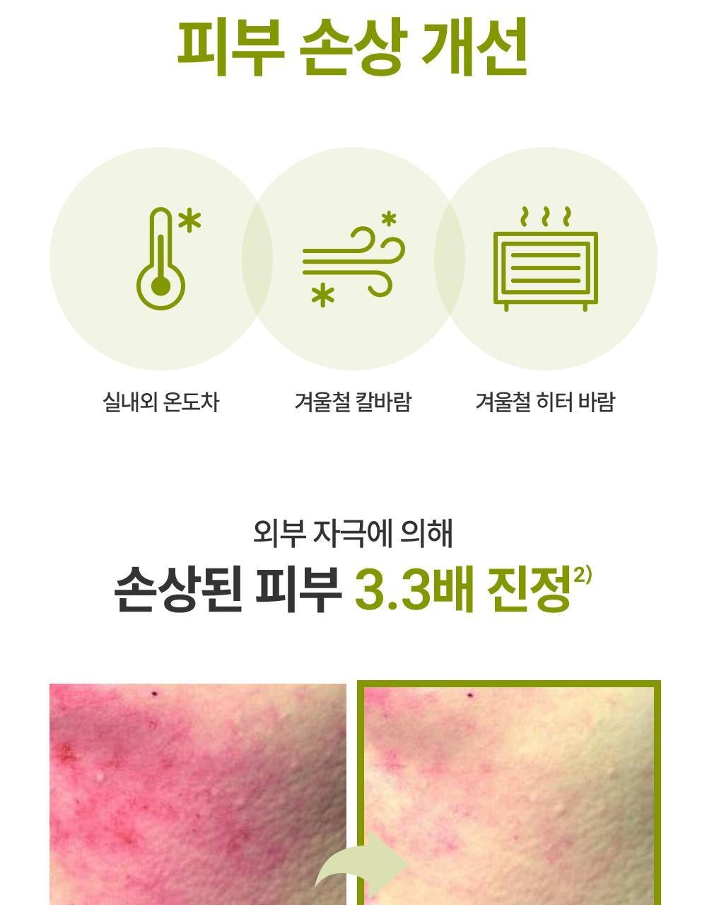 ZEROID 急救密集修護霜| 榮獲 2025 OLIVE YOUNG 大賞「MD推薦」🏆