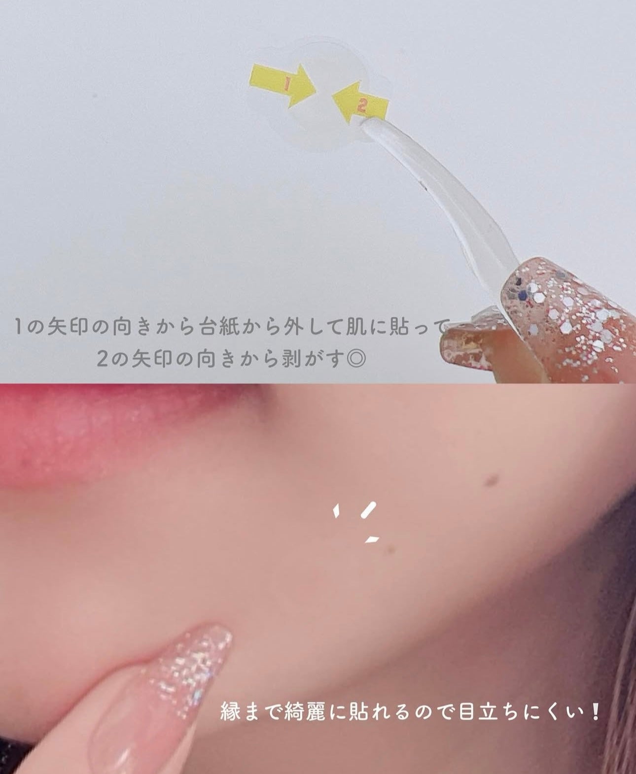 韓國 CATCH ME PATCH可愛去痘暗瘡貼 💖