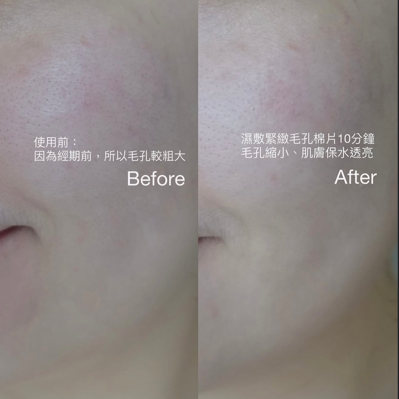 Ilso辣木籽緊緻毛孔修護棉片🫧| ilso Moringa Purifying Pore Pad🩵