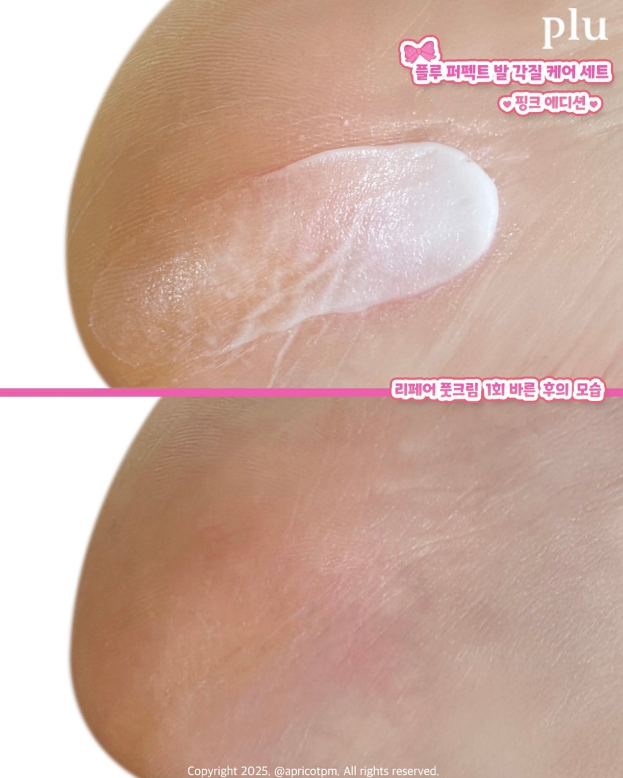 送死皮刮刀✨Plu 強效角蛋白強化修護足霜+完美足部去角質套裝 🦶🏻| PLU Intensive Repair Foot Cream