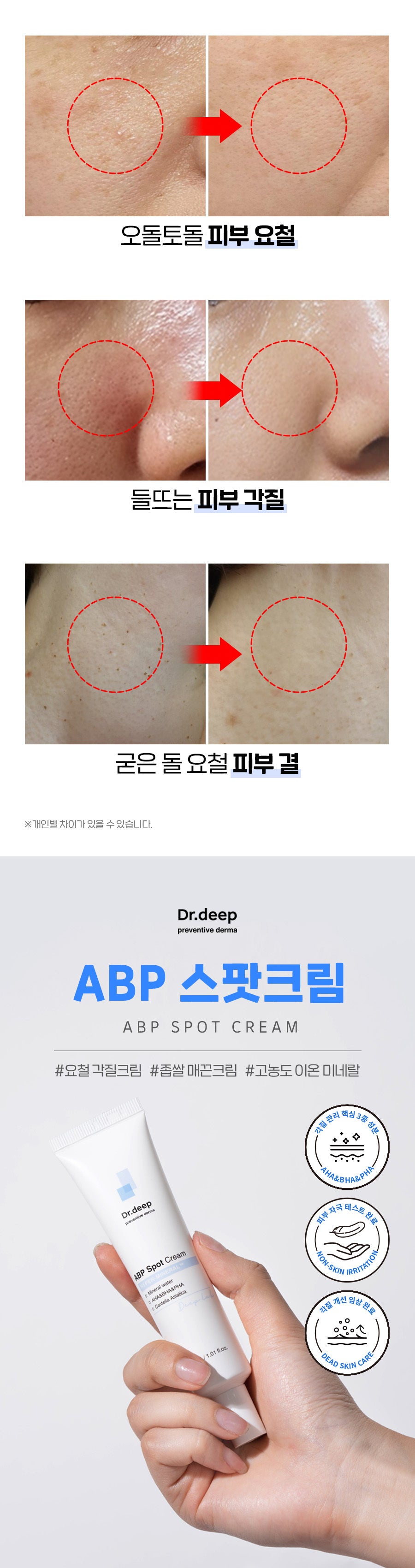 最新版本🔥Dr.Deep 煥膚奇蹟霜✨水嫩無瑕 4D 去印修護霜Dr.Deep Clinical Texture Turnover Spot Cream