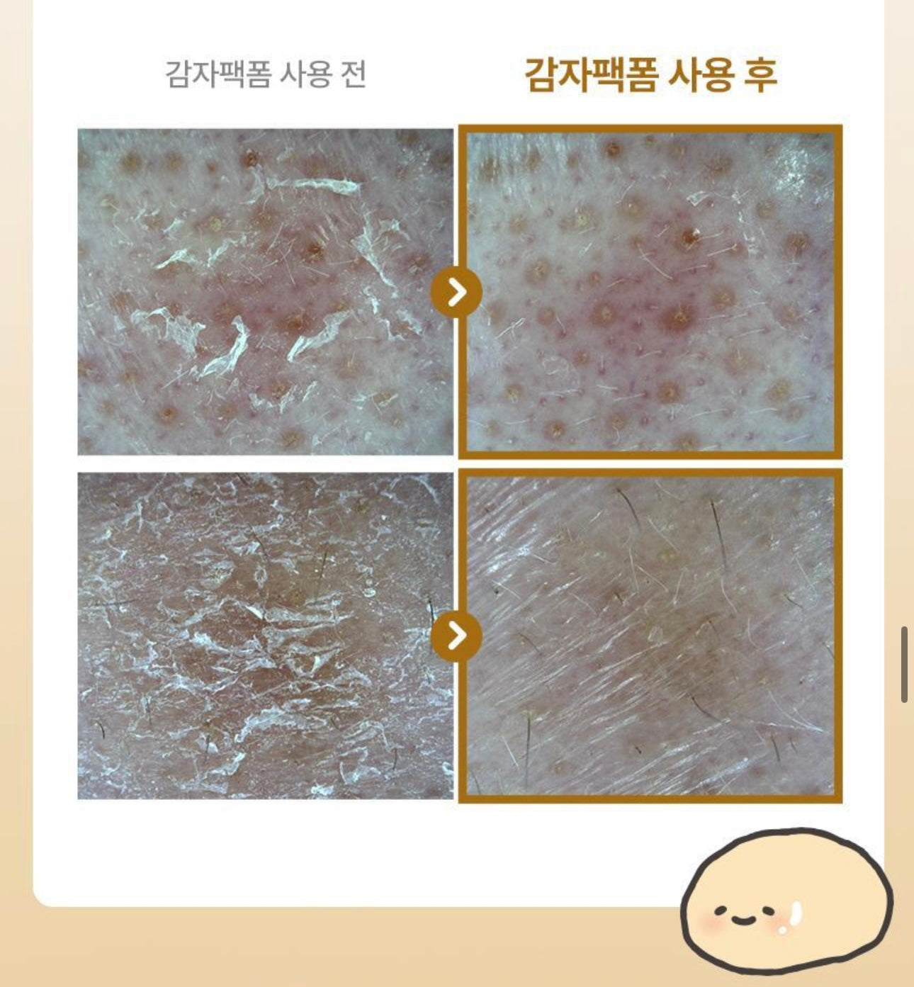 附贈洗面刷 + 薯薯貼紙|聯名限定ILSO穀物馬鈴薯淨膚泡泡潔面 🥔 限量發售🎁