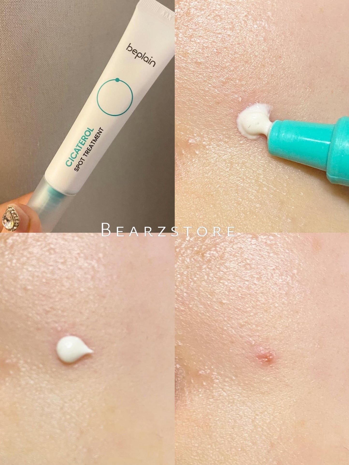 敏感痘痘肌必備✨| Beplain積雪草修復袪痘精華乳霜🌿Beplain Cicaterol Spot Treatment