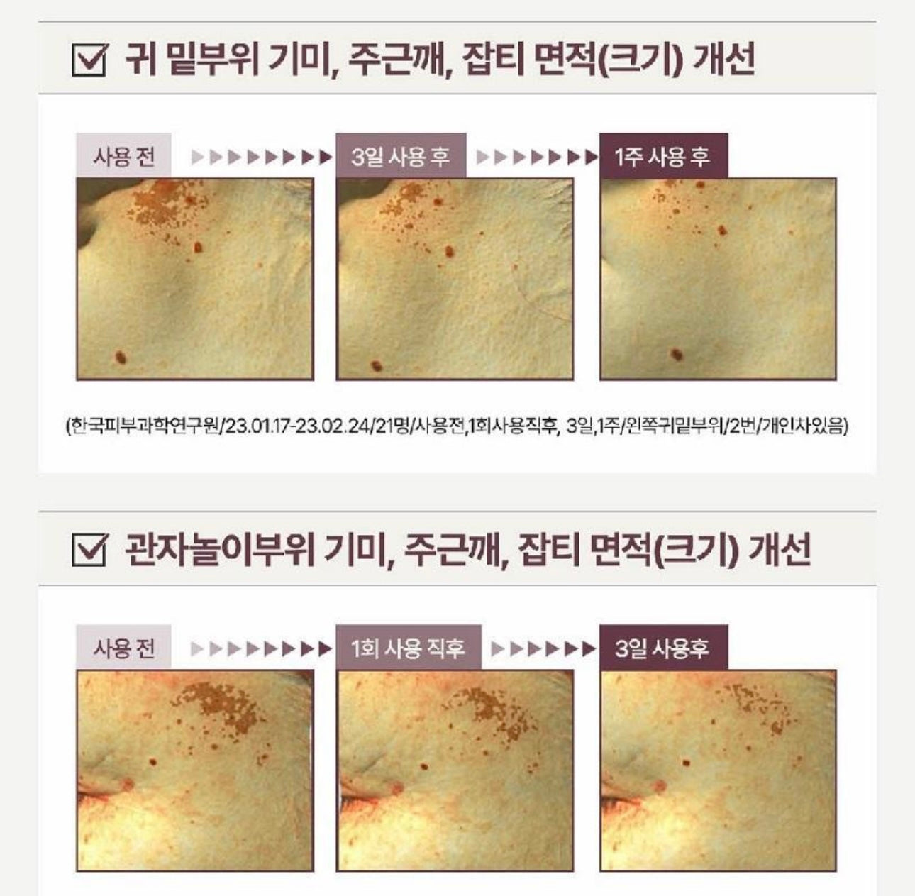 醫藥級研發⭐️Centellian24 高濃度美白修復精華| MAX韓國東國製藥研發的高效淡斑精華💛