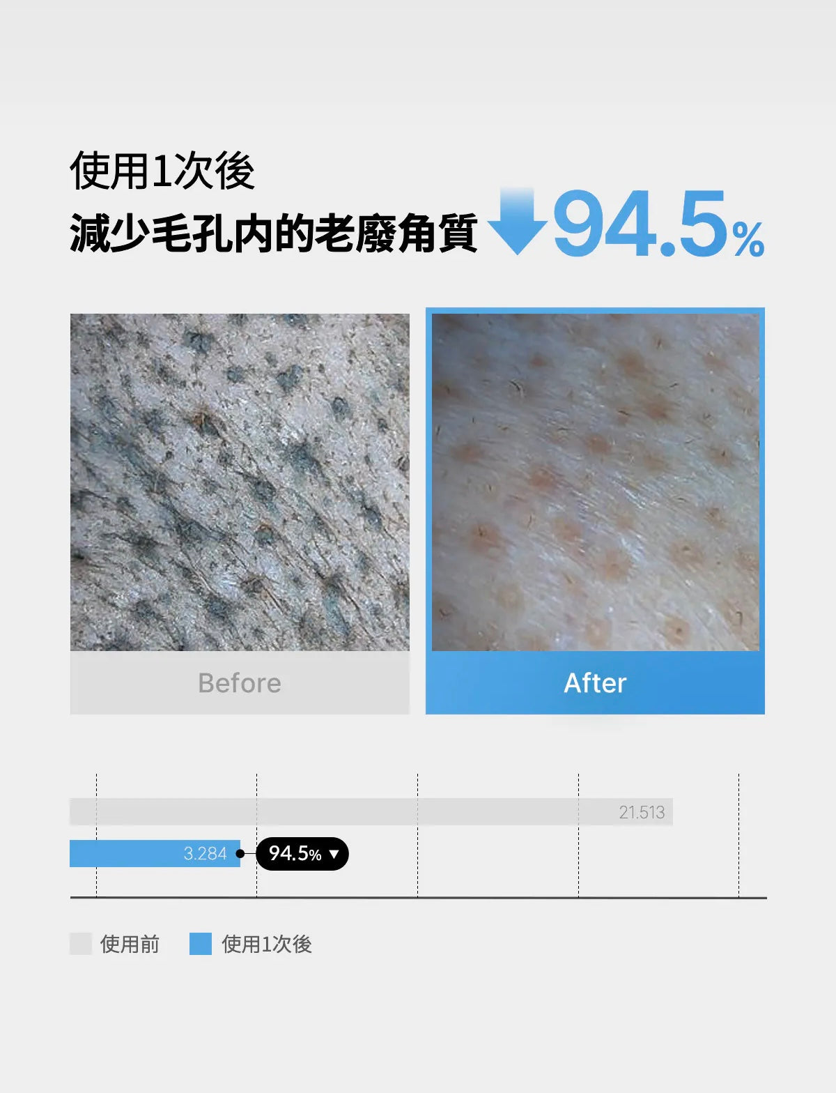 Medicube Zero黑頭毛孔淨化卸妝油🩵| Medicube Zero Pore Blackhead Deep Cleansing Oil