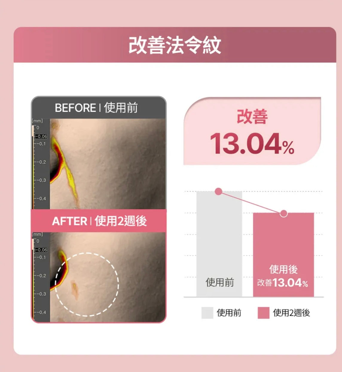 肌膚越用越年輕！Face Fit Wrinkle Patch 小熨斗皺紋貼 ⭐️
