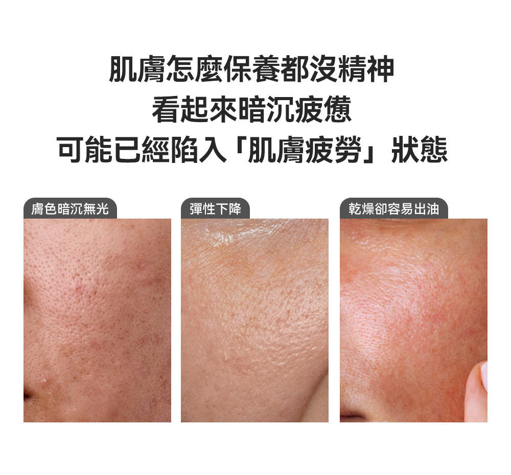 送寵物小精靈包包✨ 高濃度 NMN 配方💫| Sungboon Editor 綠蕃茄NMN立體塑顏毛孔精華🌿🍅升級版✨