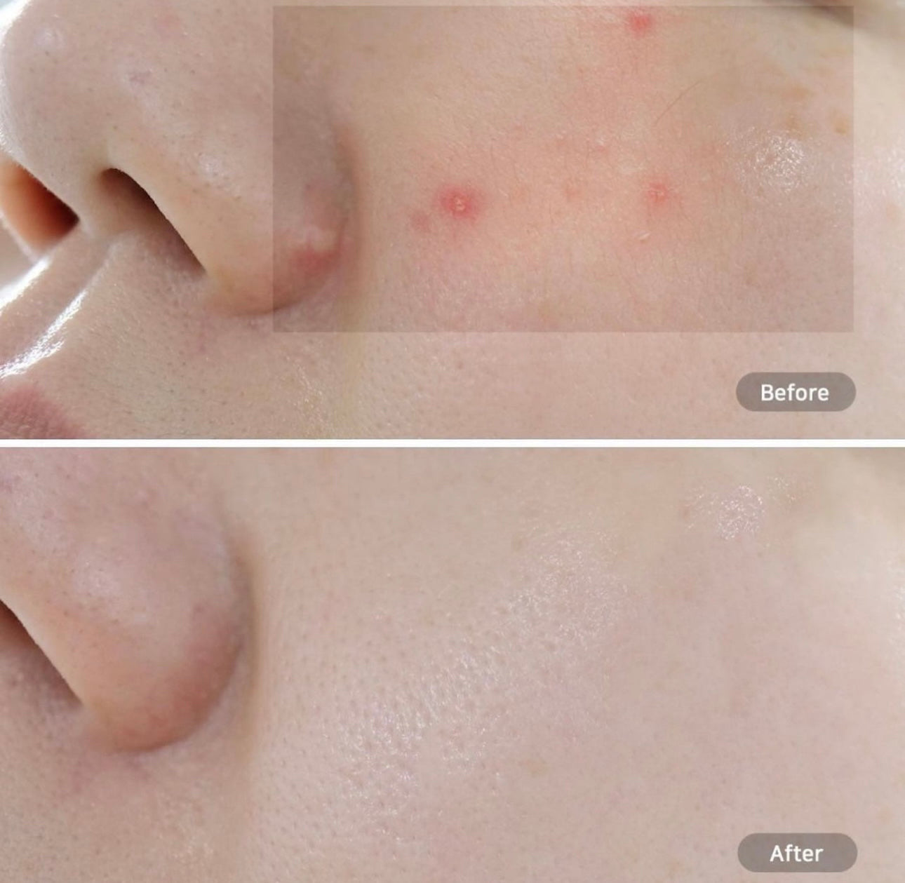 巨量裝🔥自留🌿韓國 Hwahae 美容大賞 No.1✨| Beplain 平衡pH值氨基酸絲滑綠豆洗面奶Beplain Greenful pH-balanced Cleansing Foam | 滿意度高達 98.4%🌿