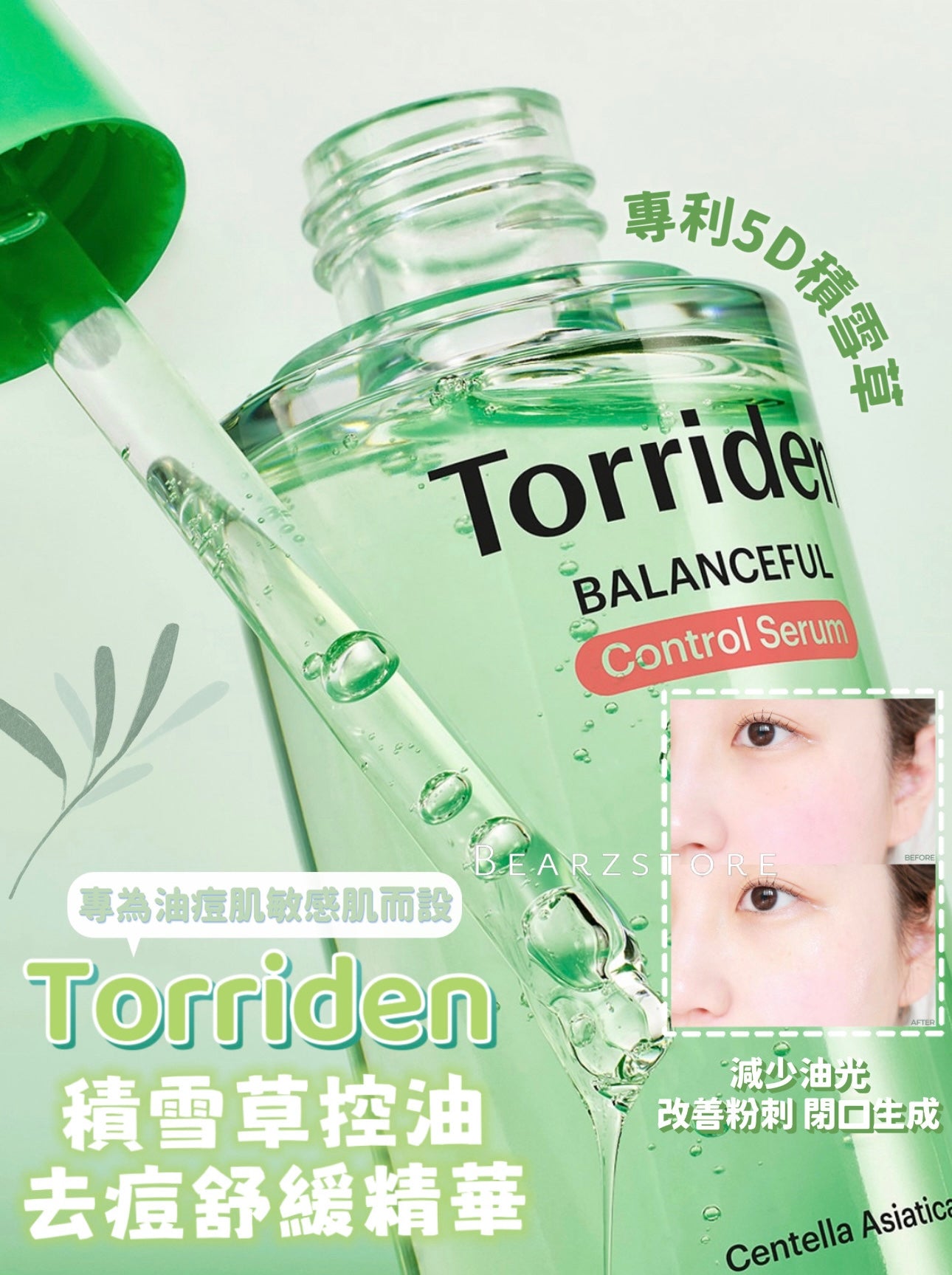 送面霜/爽膚水✨新升級⭐️ Torriden 積雪草控油去痘舒緩精華🌿 | Torriden Balanceful Control Serum| 專為油痘肌敏感肌打造⭐️