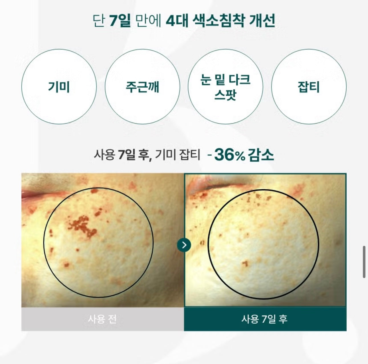 7天煥亮挑戰🌟| Boncept 維C雙重凍乾活力美白安瓶| 300 IU純視黃醇 × 凍乾維C膠囊💊